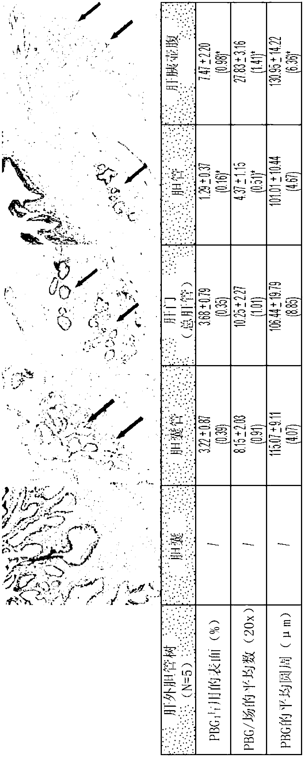 Multipotent stem cells from the extrahepatic billary tree and methods of isolating same