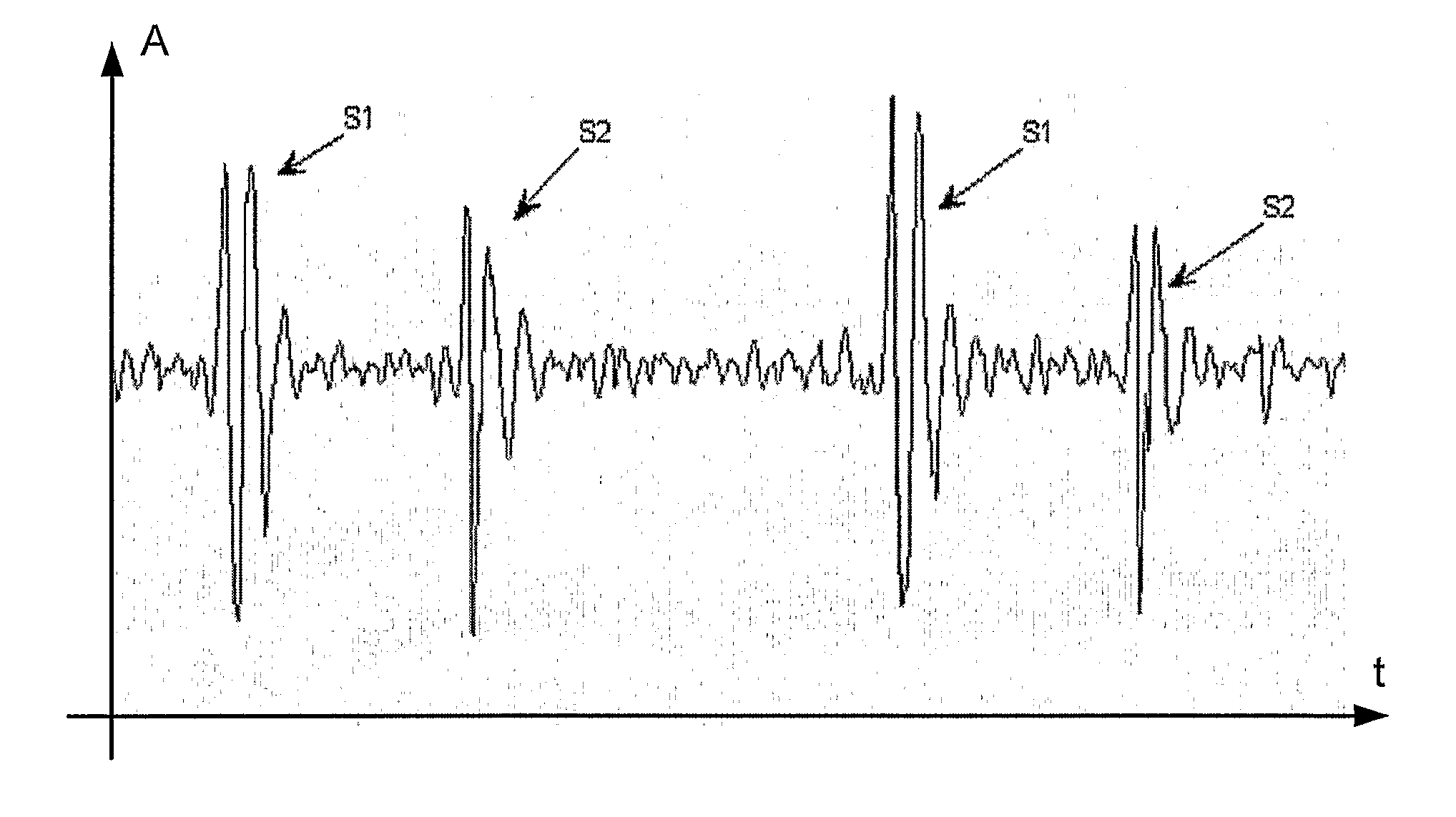 Multi parametric classification of cardiovascular sounds