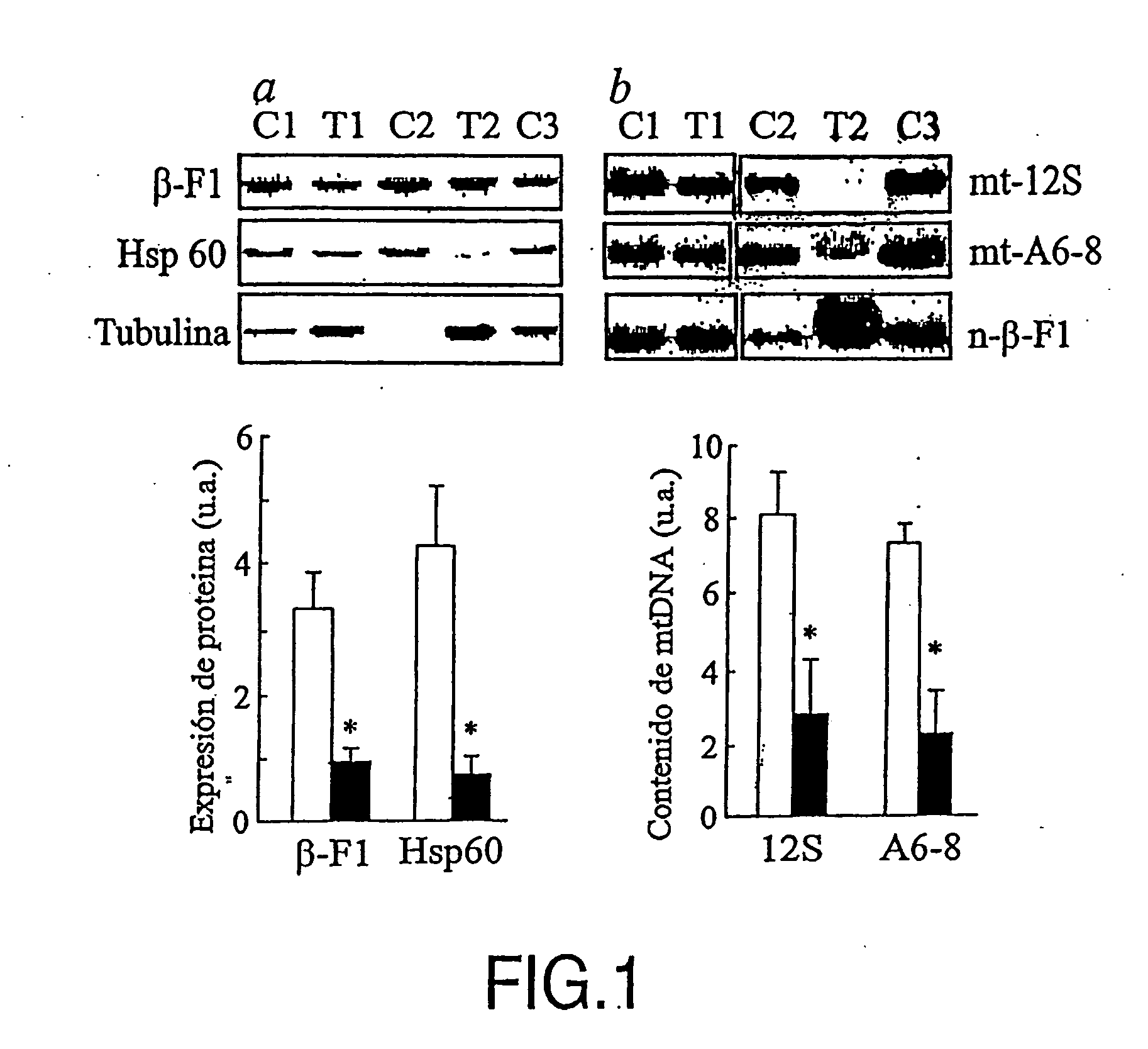 Method for cancer detection, progression analysis and malign tumour prognosis based on the study of metabolic markers of the cell