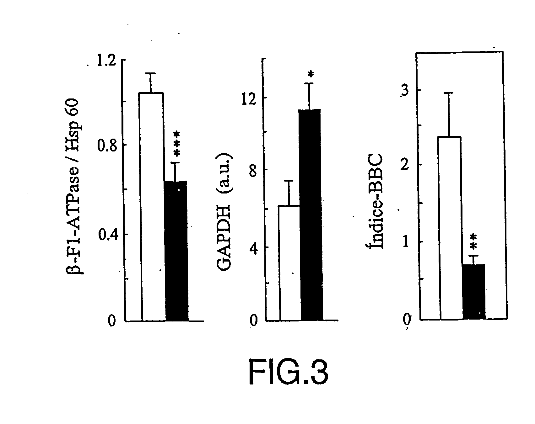 Method for cancer detection, progression analysis and malign tumour prognosis based on the study of metabolic markers of the cell