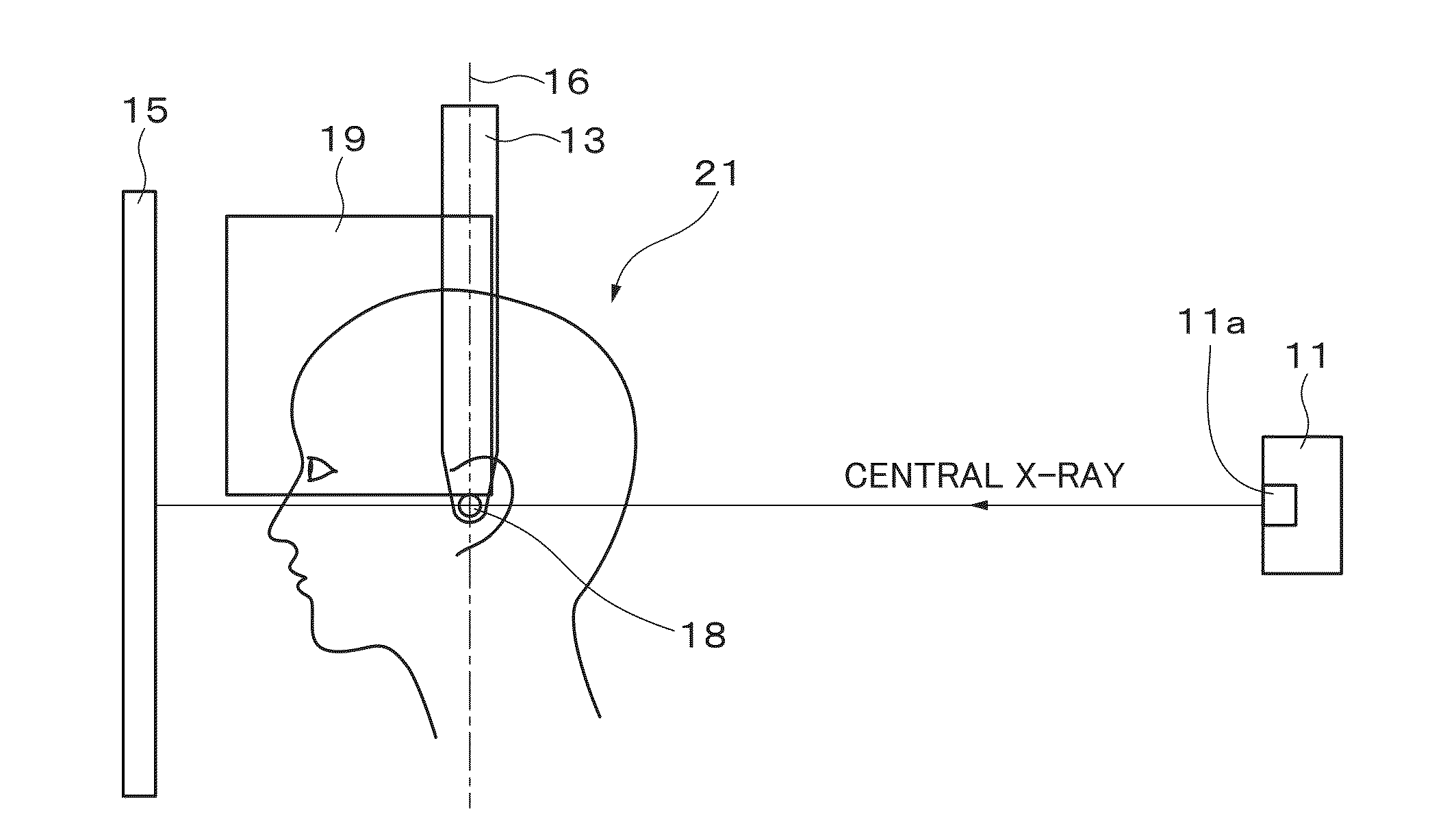 X-ray radiographic apparatus, method of measuring head tilt in taking radiograph, stand for x-ray radiographic apparatus, chair for x-ray radiographic apparatus, and head tilt setting device