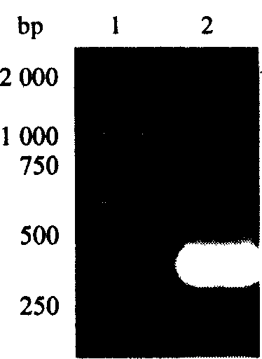 Short peptide for inhibiting Shiga toxin and application thereof