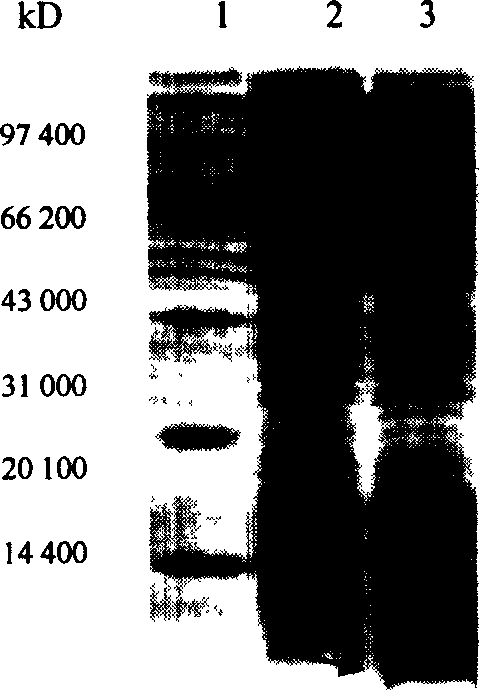 Short peptide for inhibiting Shiga toxin and application thereof