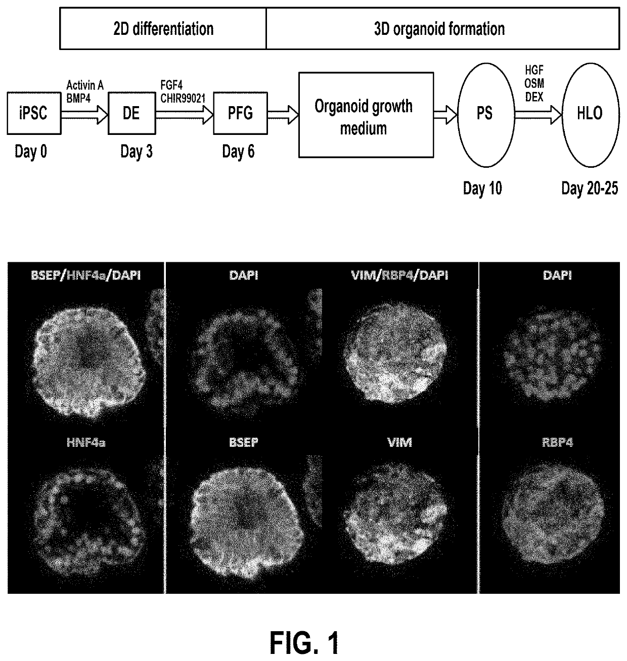 Liver support system comprising liver organoids and methods of making and using same