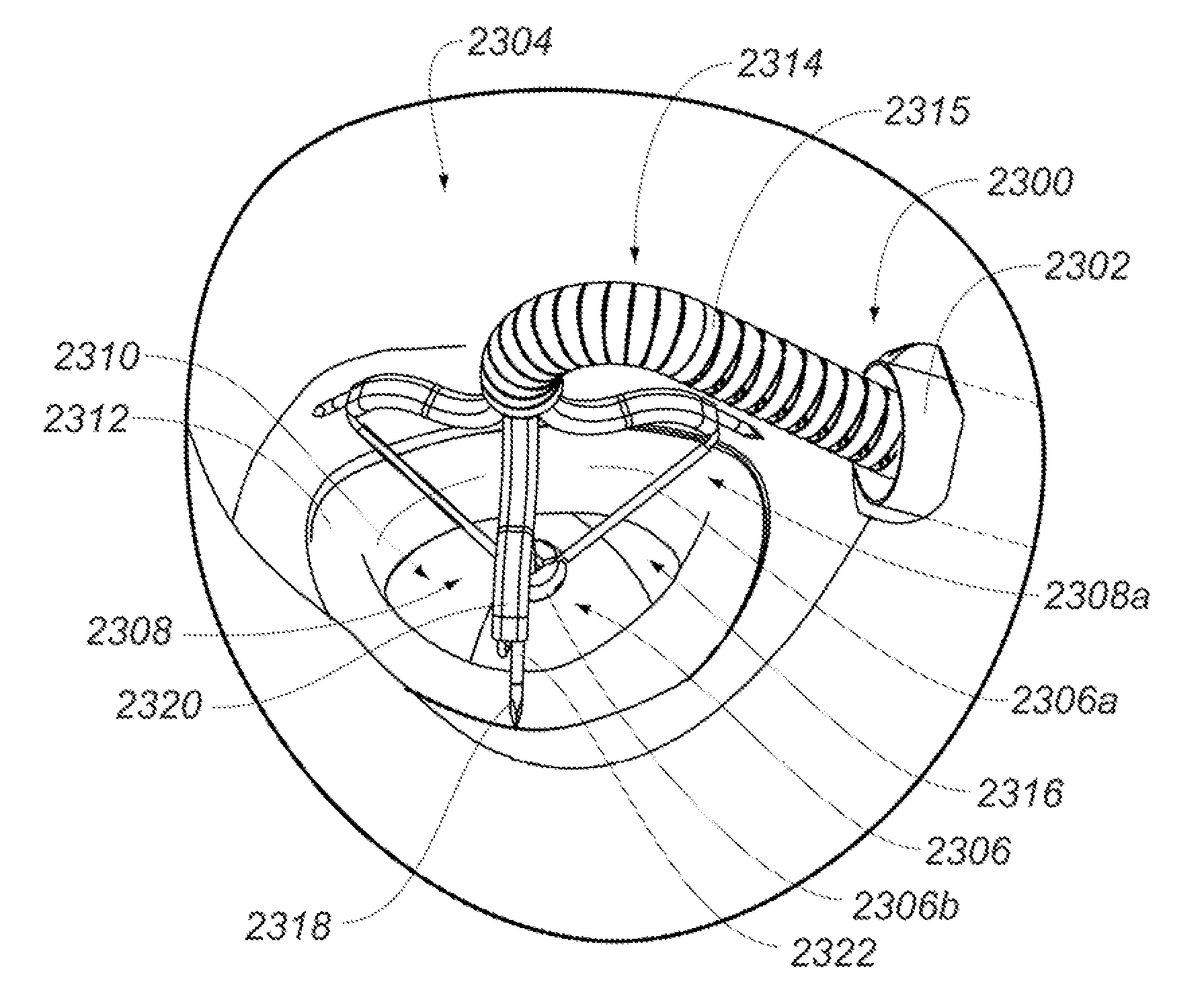 Medical device, kit and method for constricting tissue or a bodily orifice, for example, a mitral valve