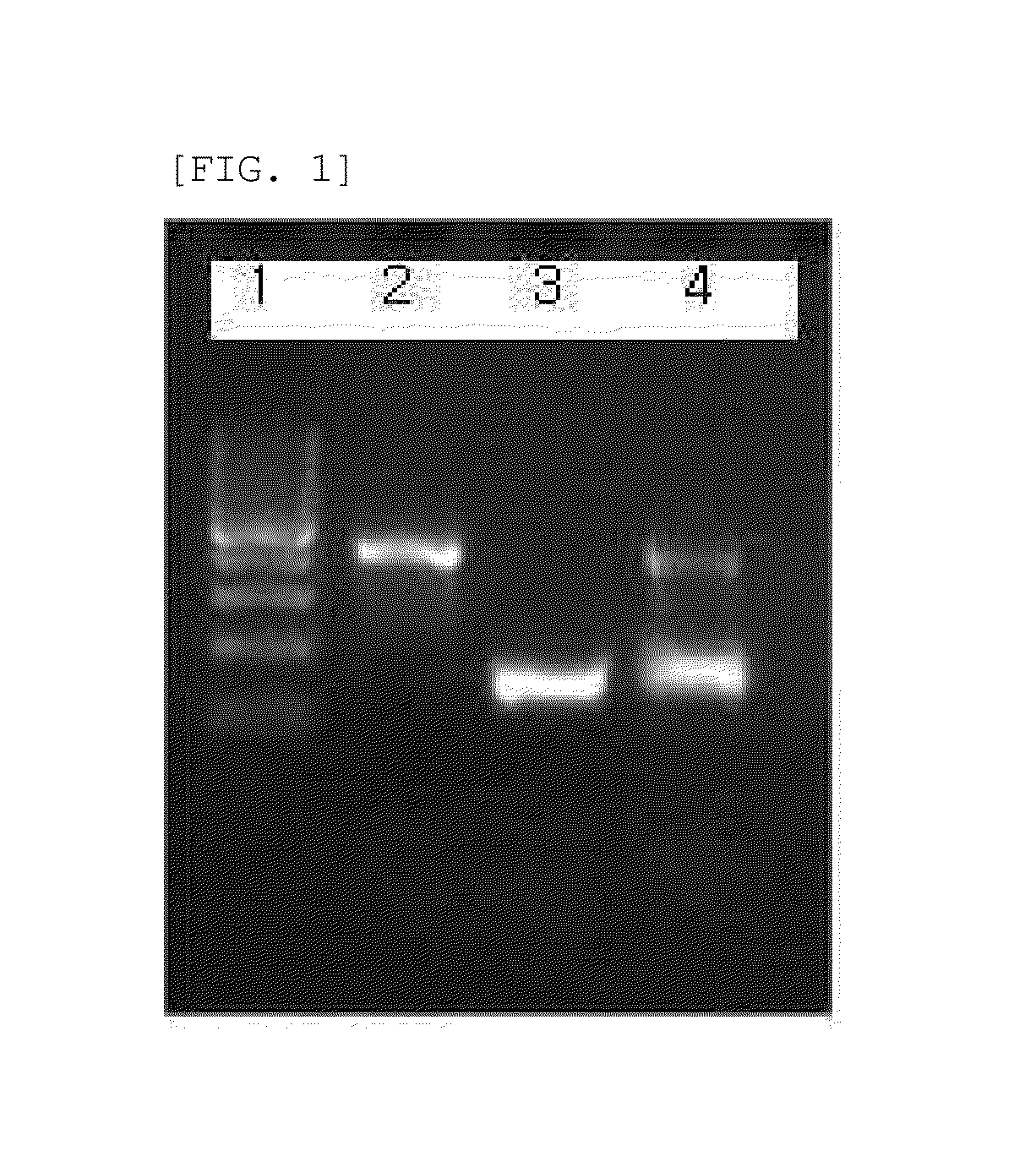 Method for detecting mycobacterium tuberculosis and nontuberculous mycobacteria using duplex polymerase chain reaction