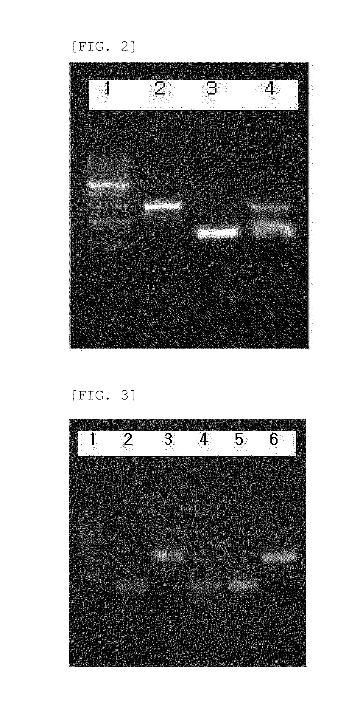 Method for detecting mycobacterium tuberculosis and nontuberculous mycobacteria using duplex polymerase chain reaction