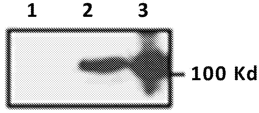 Treatment of cancer using recall antigens delivered by attenuated bacteria