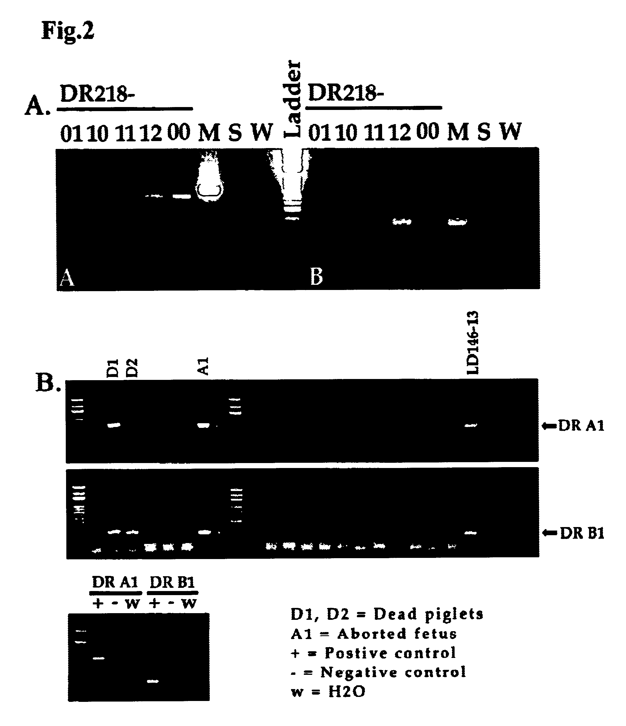 Transgenic swine having HLA-D gene, swine cells thereof and xenografts therefrom