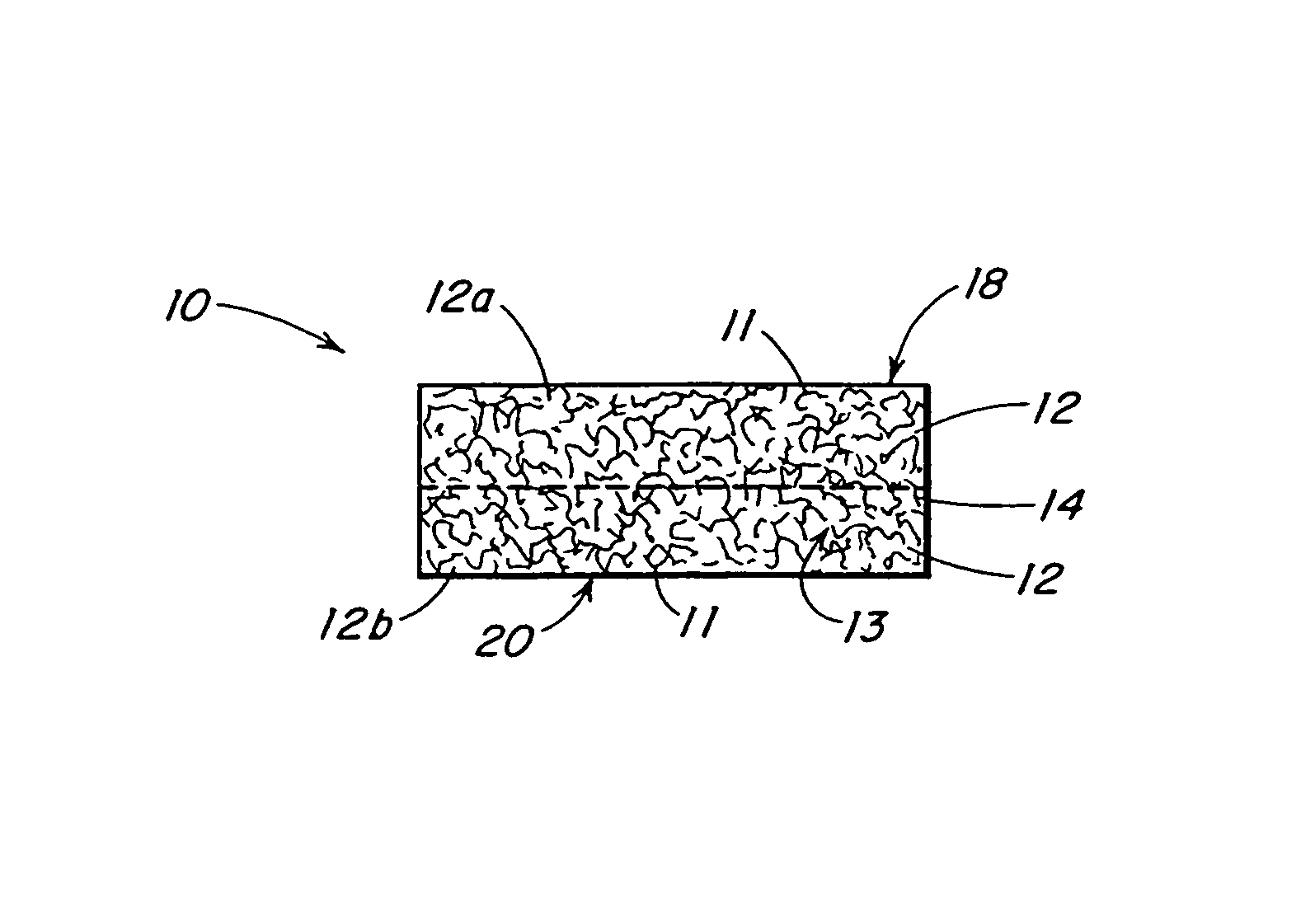 Reinforced foam implants with enhanced integrity for soft tissue repair and regeneration