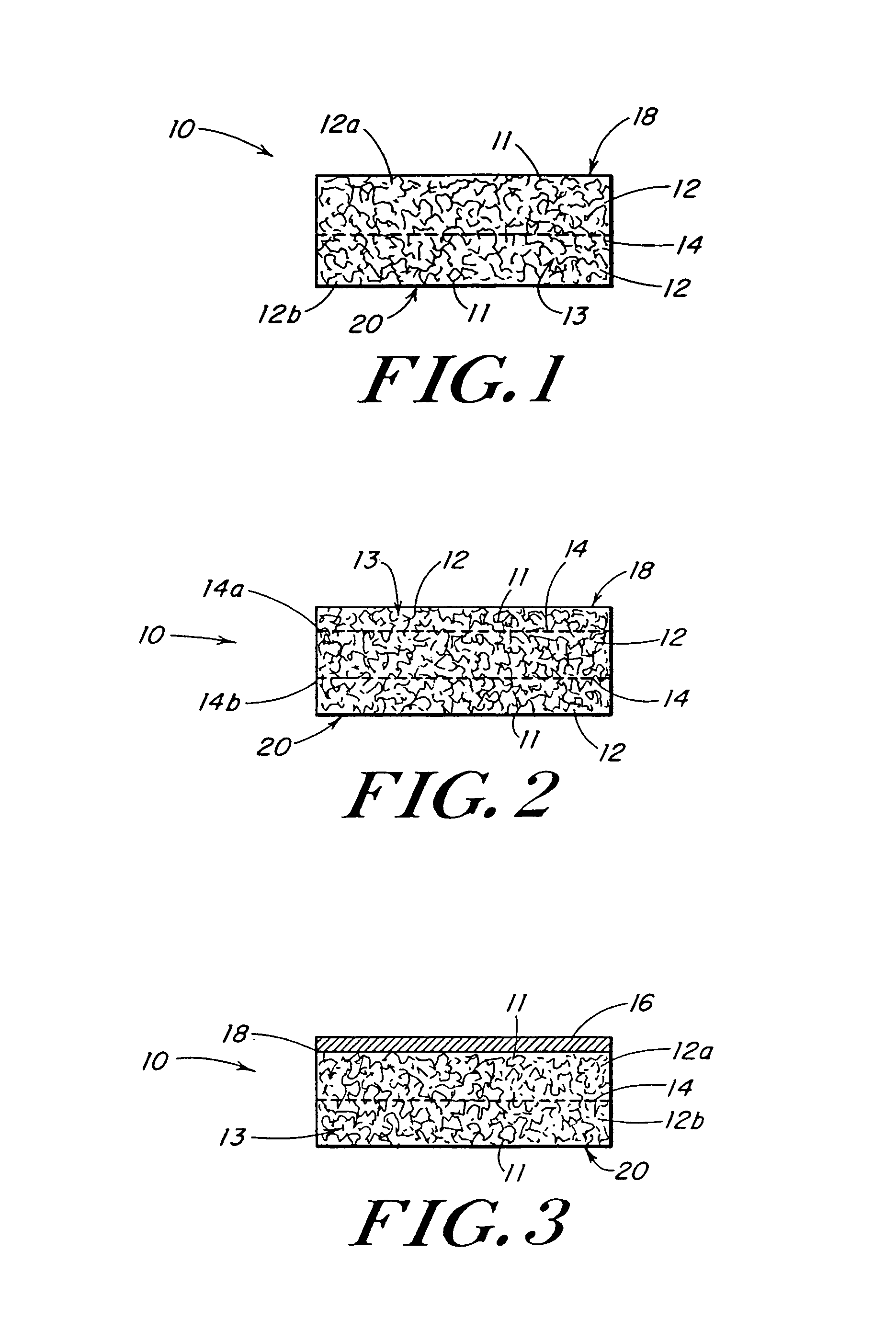 Reinforced foam implants with enhanced integrity for soft tissue repair and regeneration