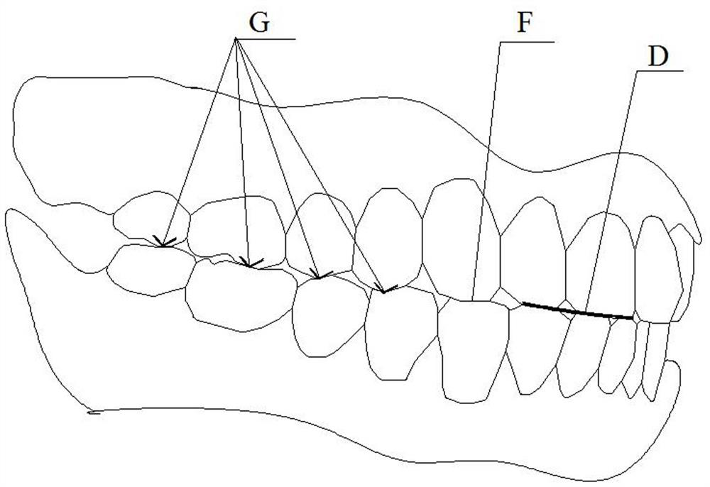 Manufacturing method of comfortable full-mouth adsorption false tooth meeting aesthetic function