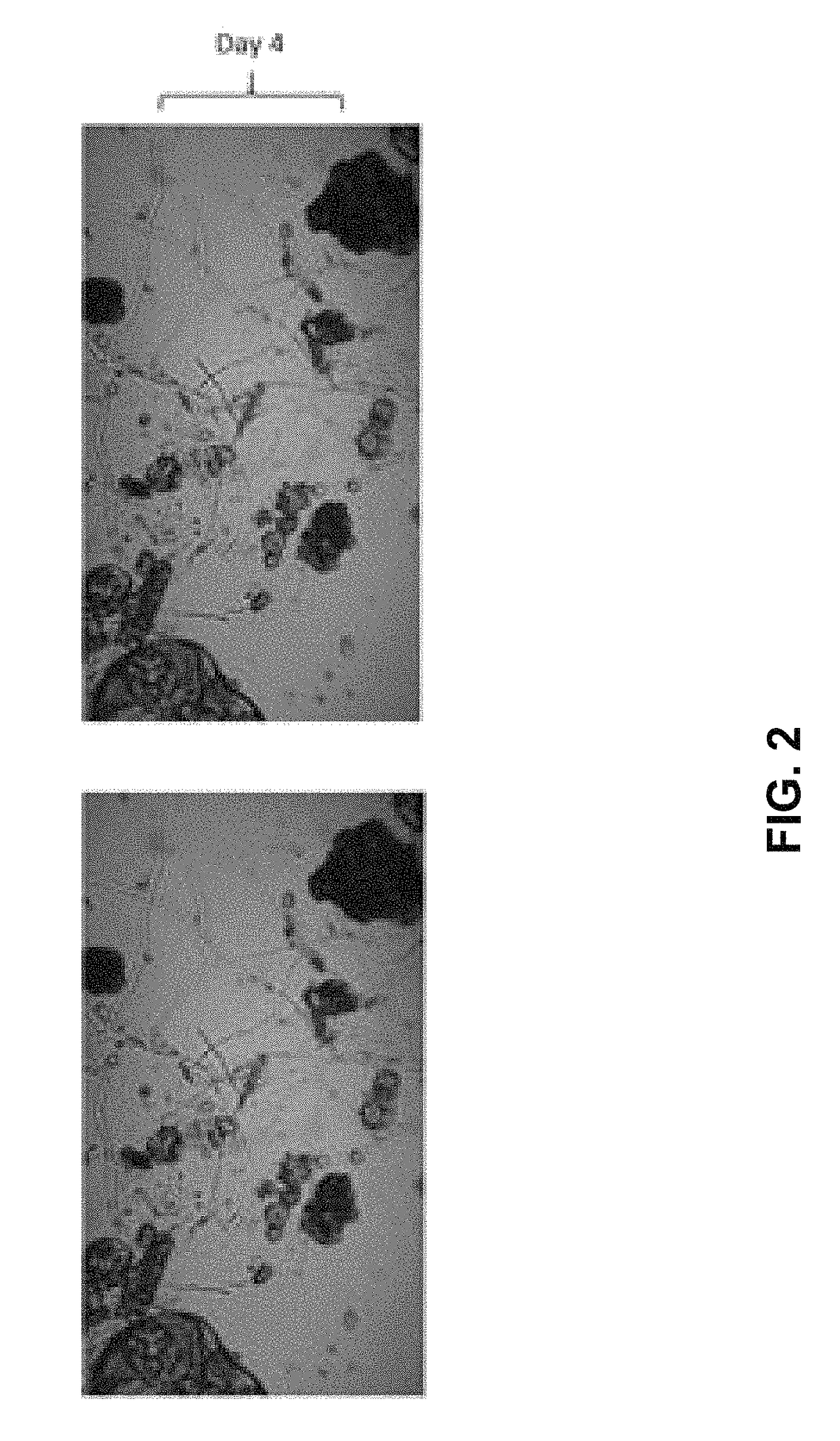 Methods for the production and use of myceliated high protein food compositions