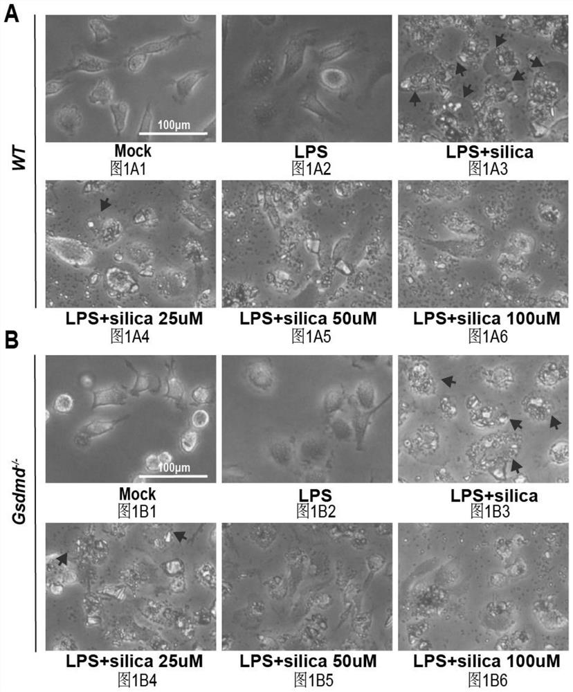 Application of dimethyl fumarate (DMF) in preparation of medicine for inhibiting pyroptosis of macrophages induced by silicon dioxide crystals and medicine for treating silicosis