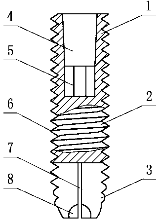 Dual-purpose implant for teaching and popularizing and promoting dental implant