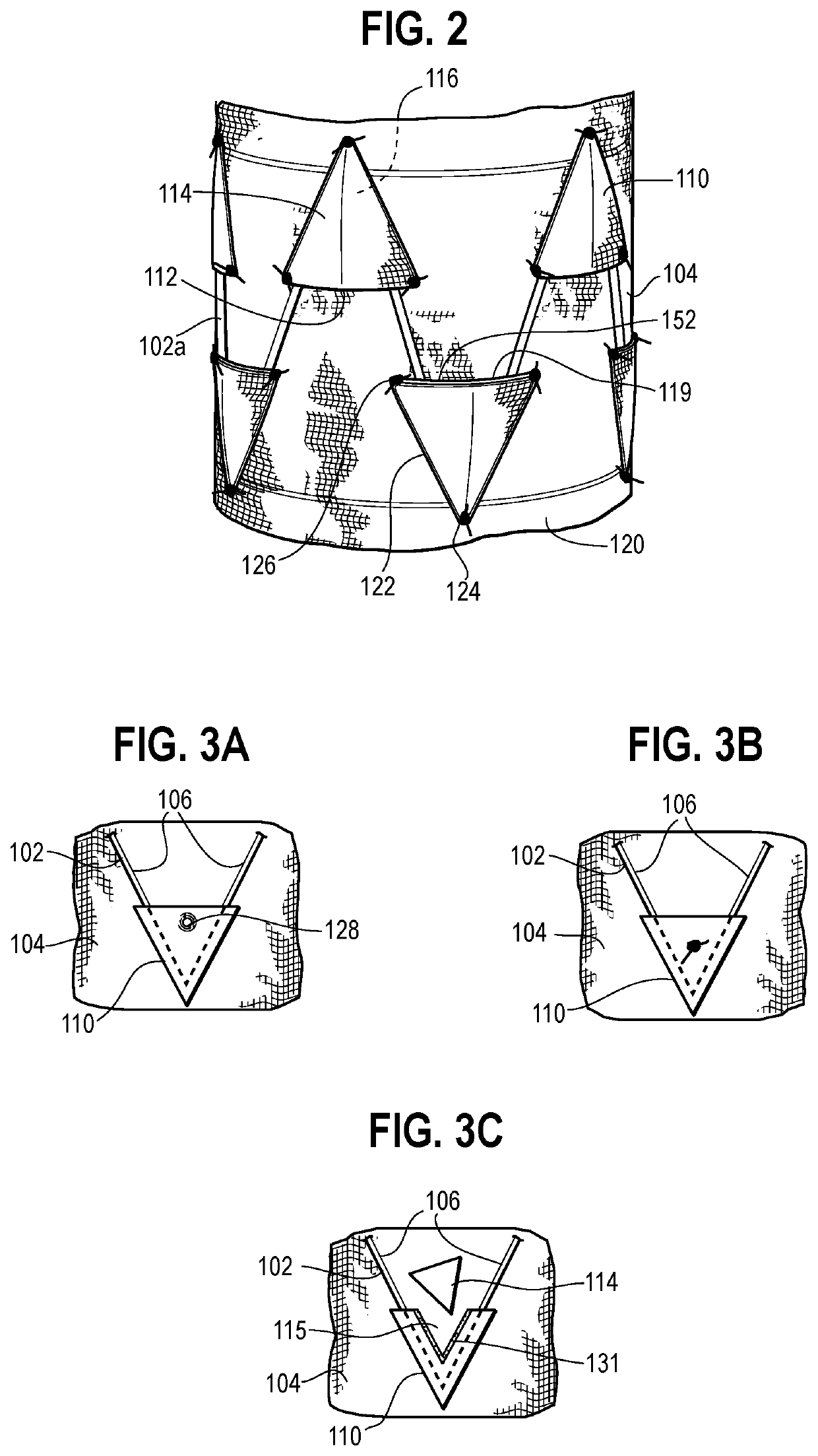 Graft having a pocket for receiving a stent and woven graft material forming a pocket