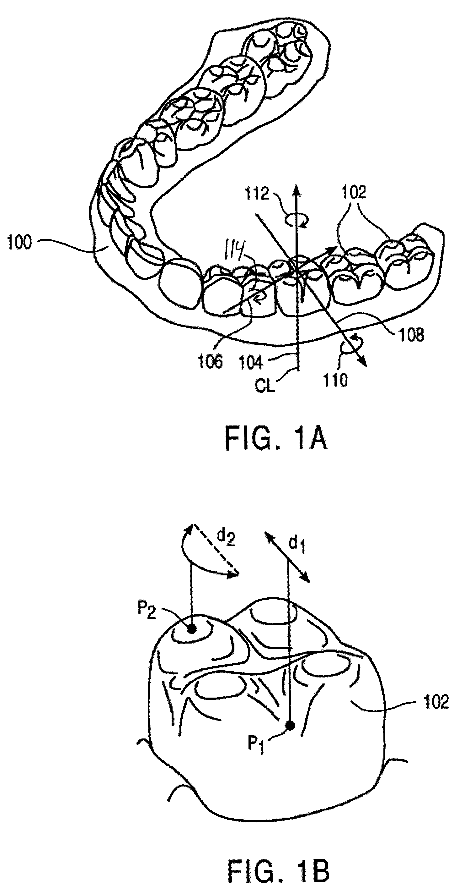 Methods and systems for treating teeth