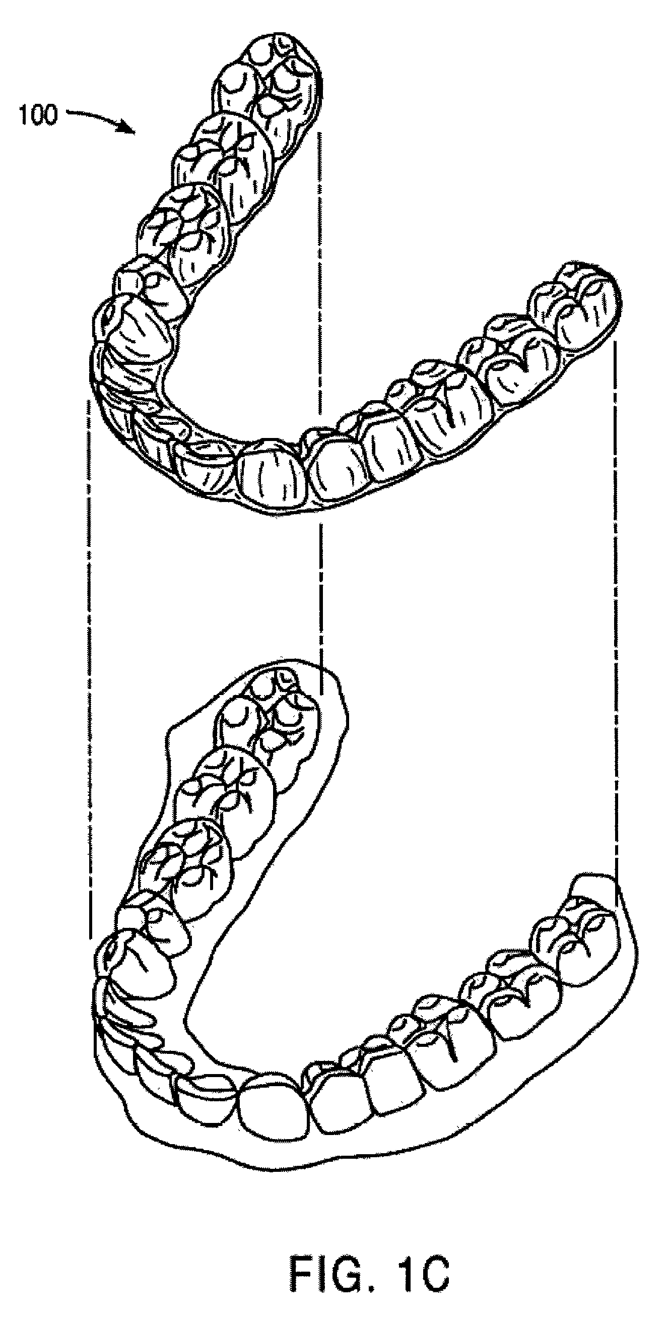 Methods and systems for treating teeth