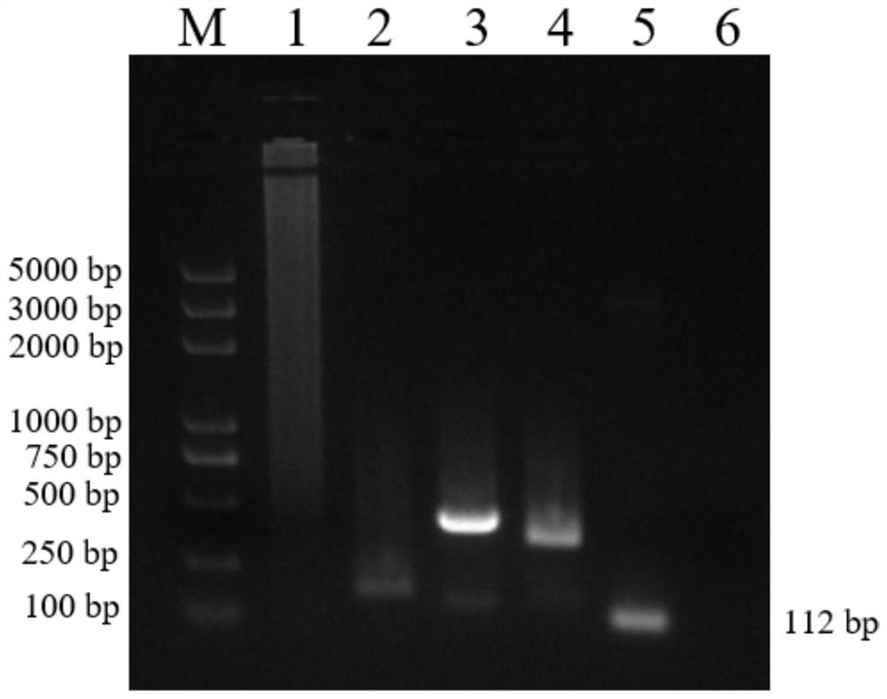 Triple rpa detection kit for bovine viral diarrhea virus, bovine coronavirus and bovine rotavirus