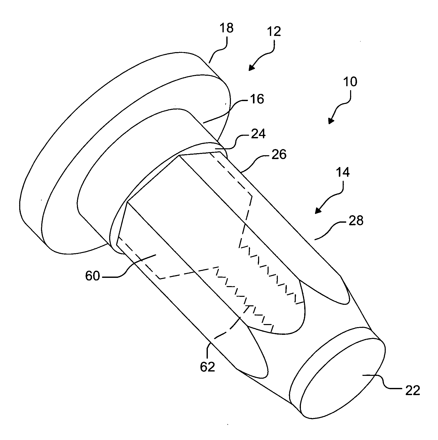 Anchor device with double-sectioned head and method of using the same