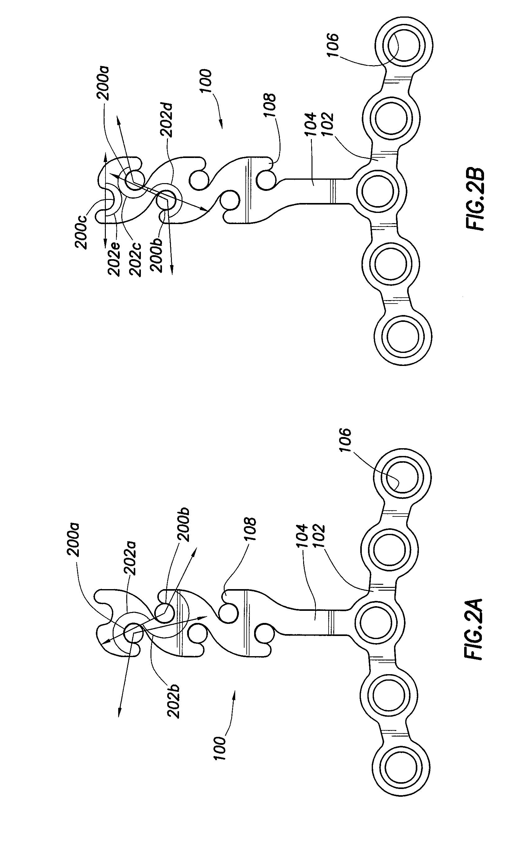 Orthodontic Plate and Method