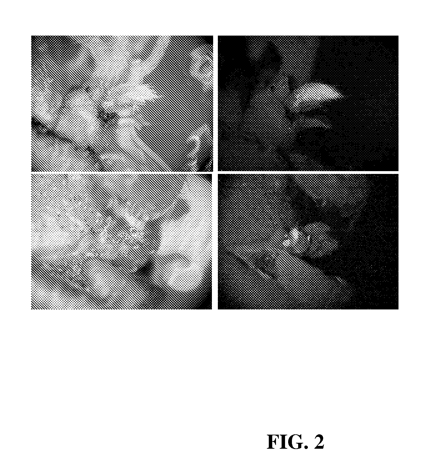 Method for selection of transformed cells