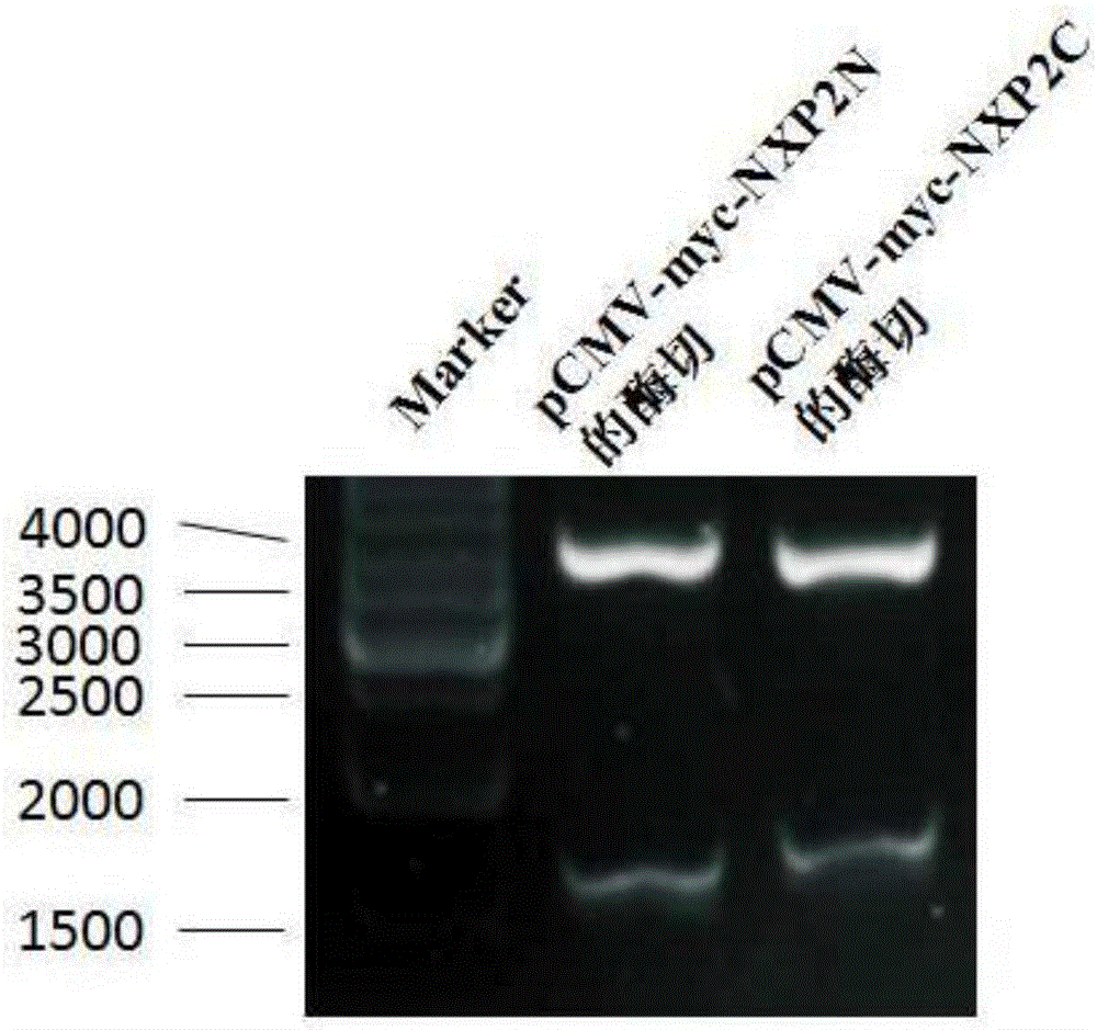 Nonradioactive labeling immunoprecipitation method for detecting NXP2 autoantibody of inflammatory myopathies and application