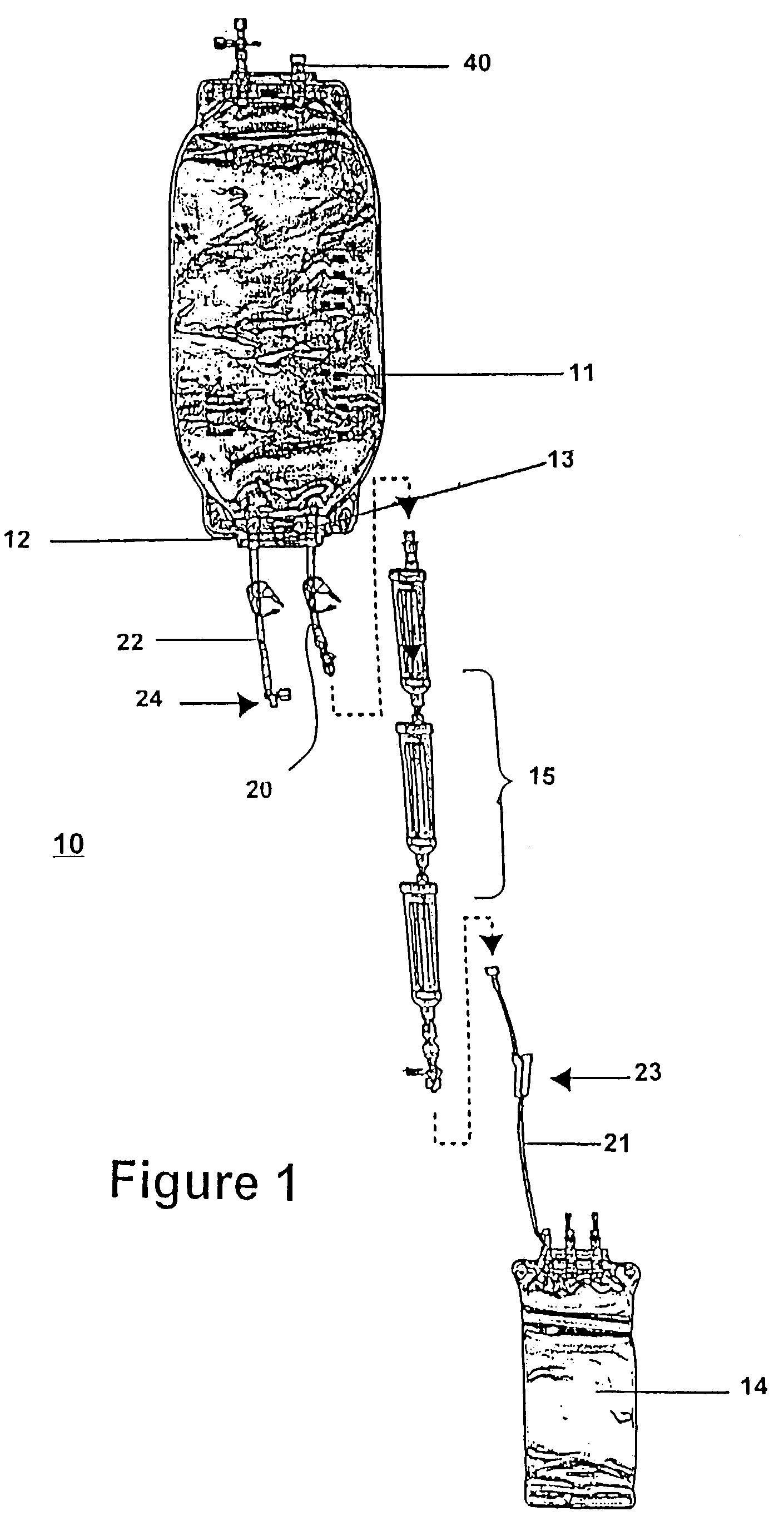 System and method for processing bone marrow