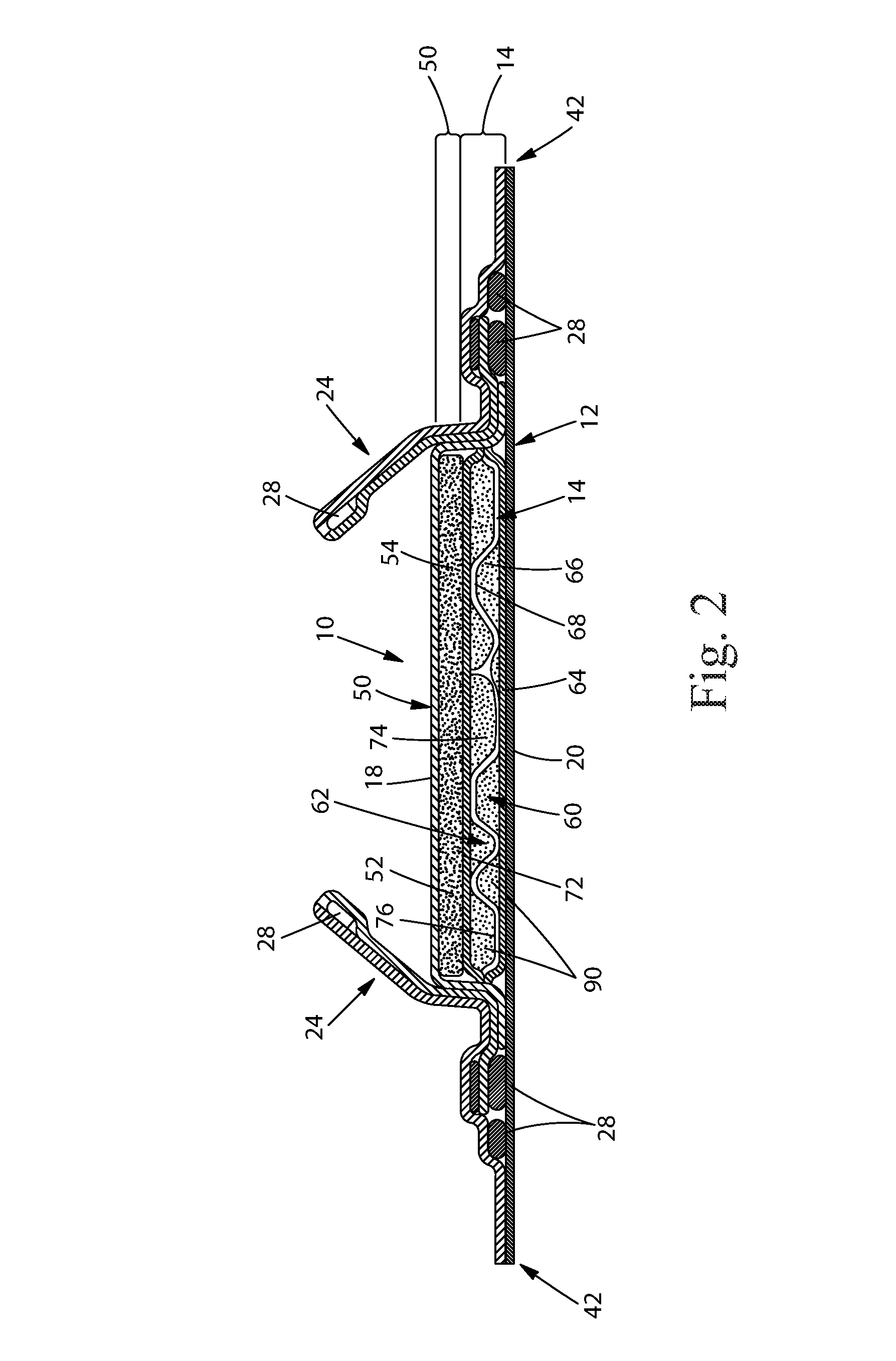 Absorbent articles with improved cores