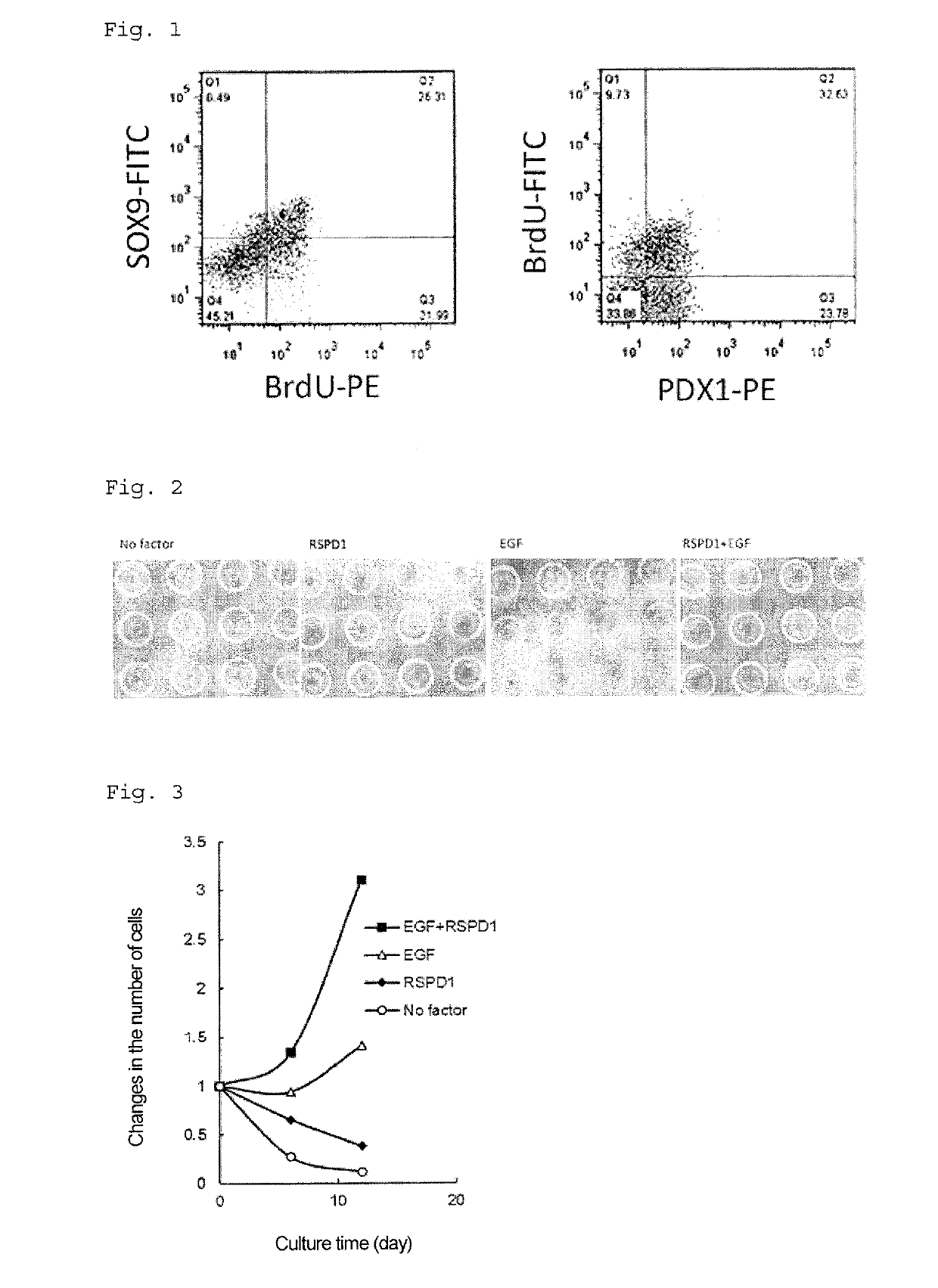 Purification method for pancreatic precursor cells derived from pluripotent stem cells and amplification method therefor