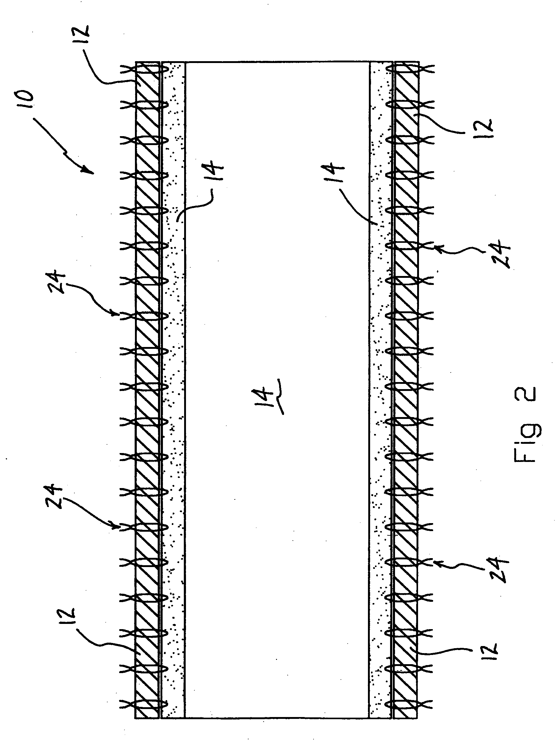 Systems and methods for overcoming or preventing vascular flow restrictions