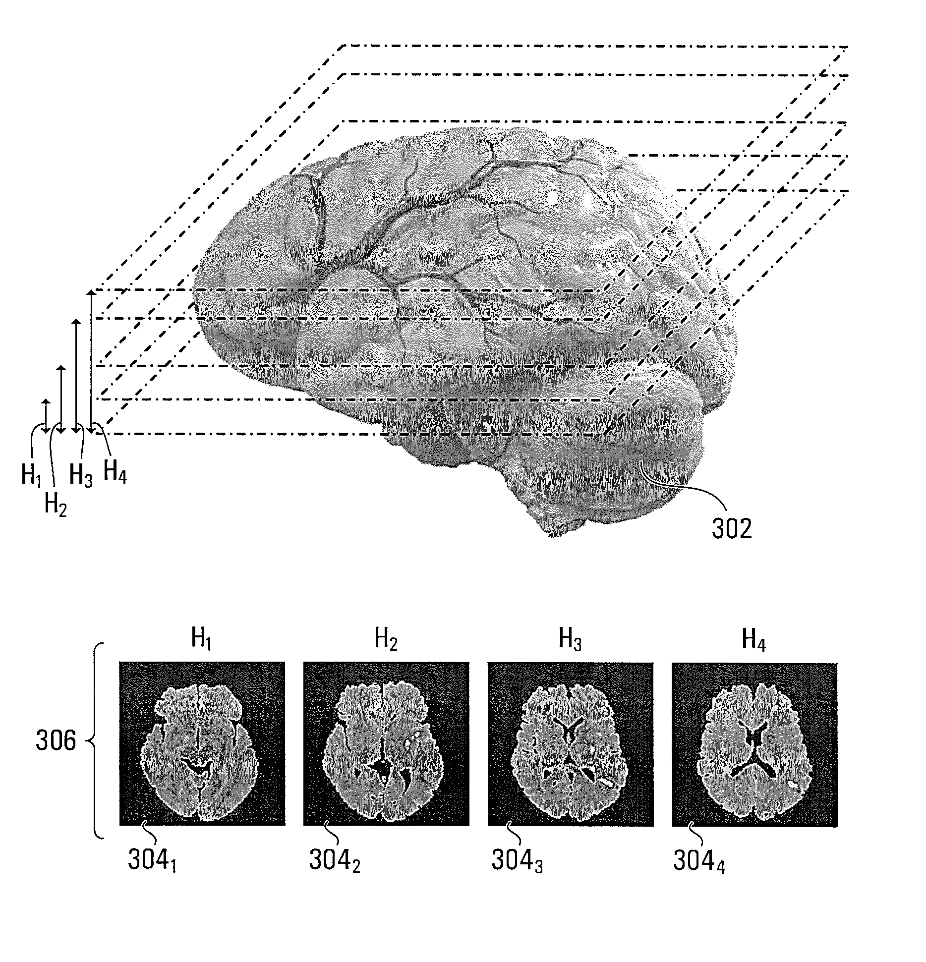 Method and system for processing multiple series of biological images obtained from a patient