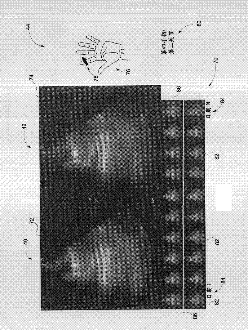 Method and system for organizing stored ultrasound data