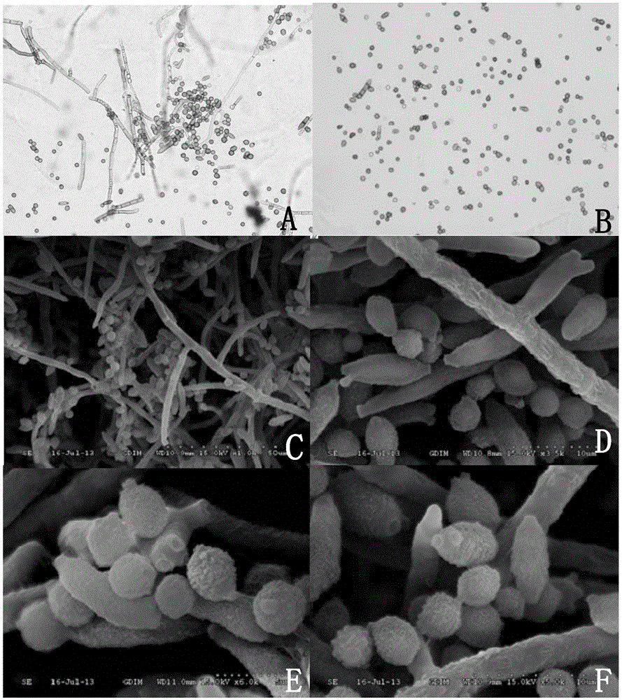 A deep-sea fungus Cladosporium and its extract and application