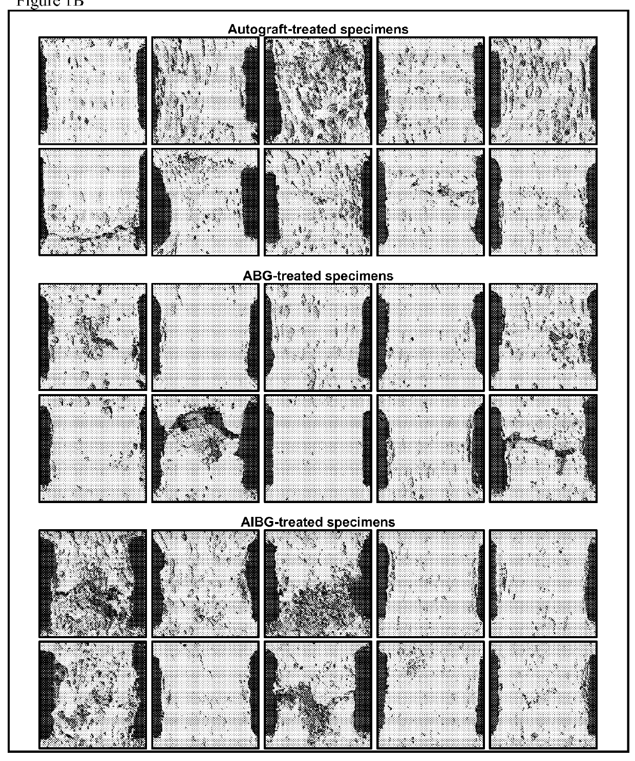 Compositions and Methods for Spine Fusion Procedures