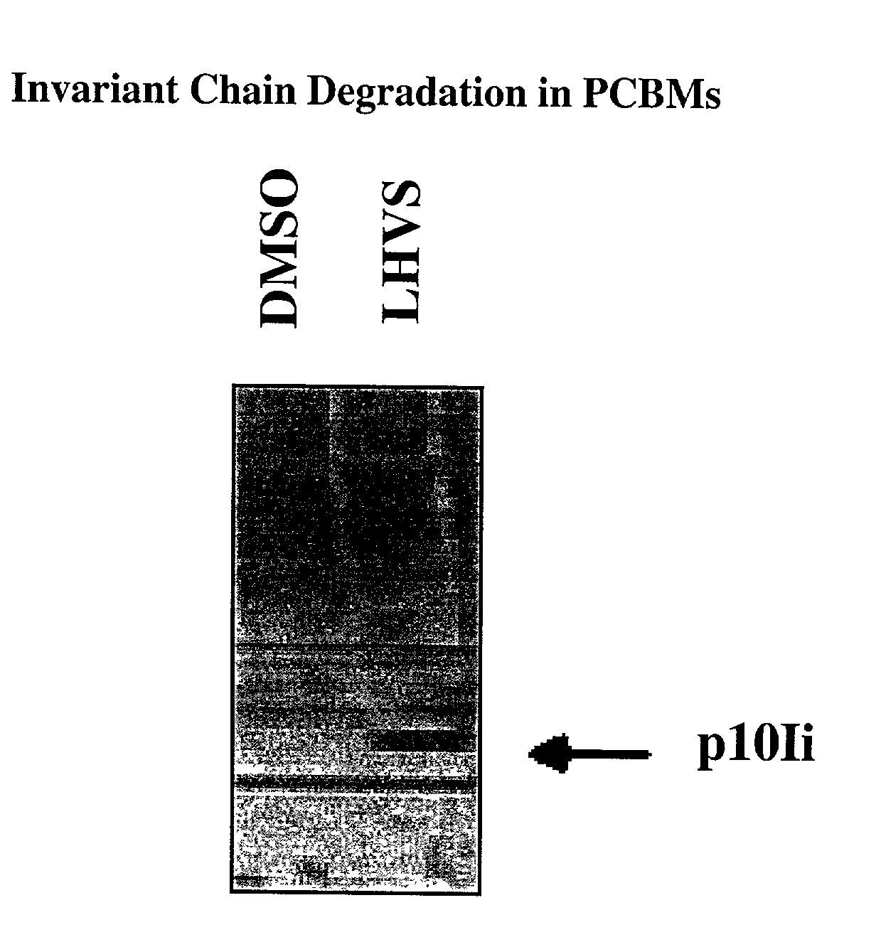 Method of monitoring the effect of Cathepsin S inhibitors