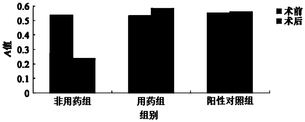 Traditional Chinese medicine composition for treating osteoporosis and preparation method thereof