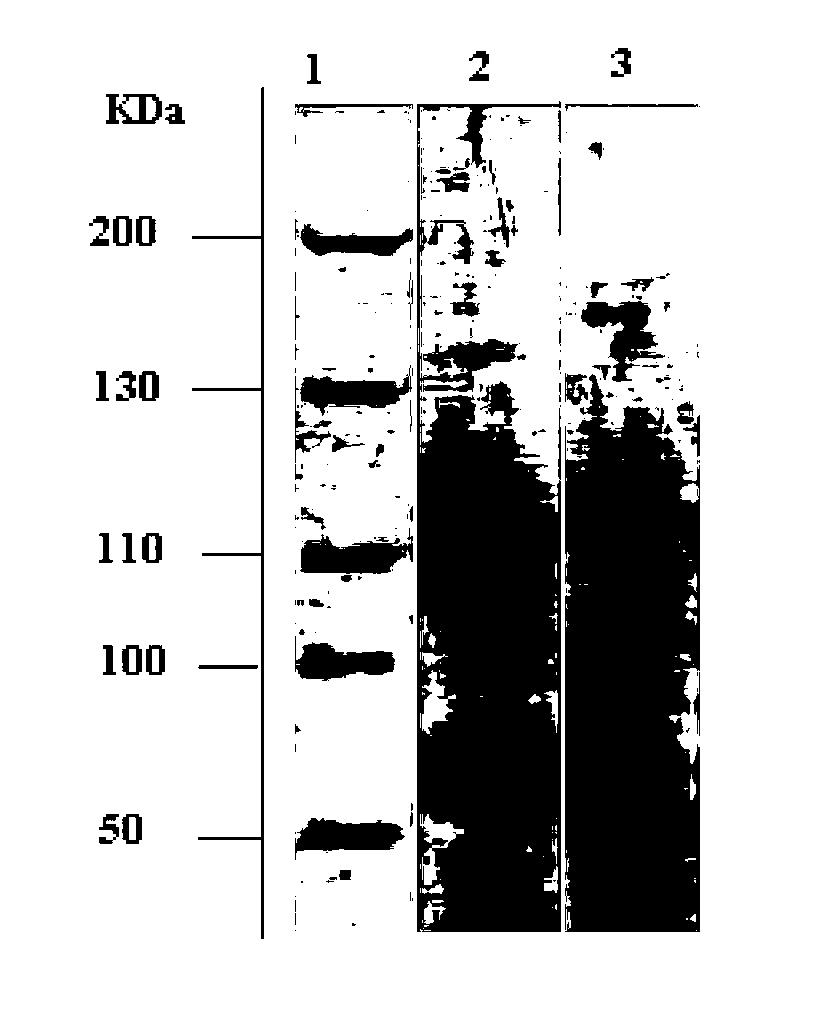 Purification method of acetylcholinesterase from earthworm serum