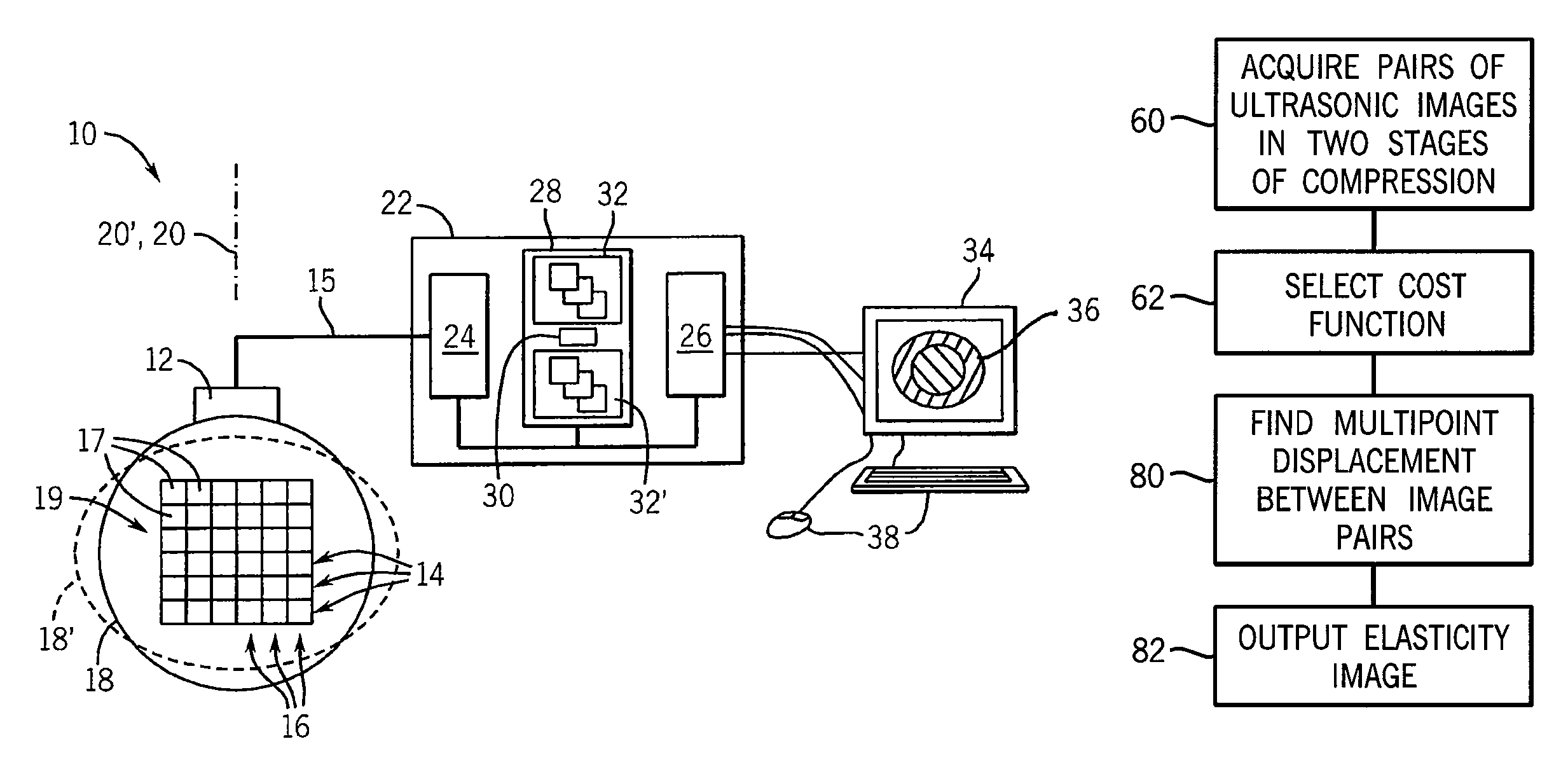 Ultrasonic strain imaging device with selectable cost-function