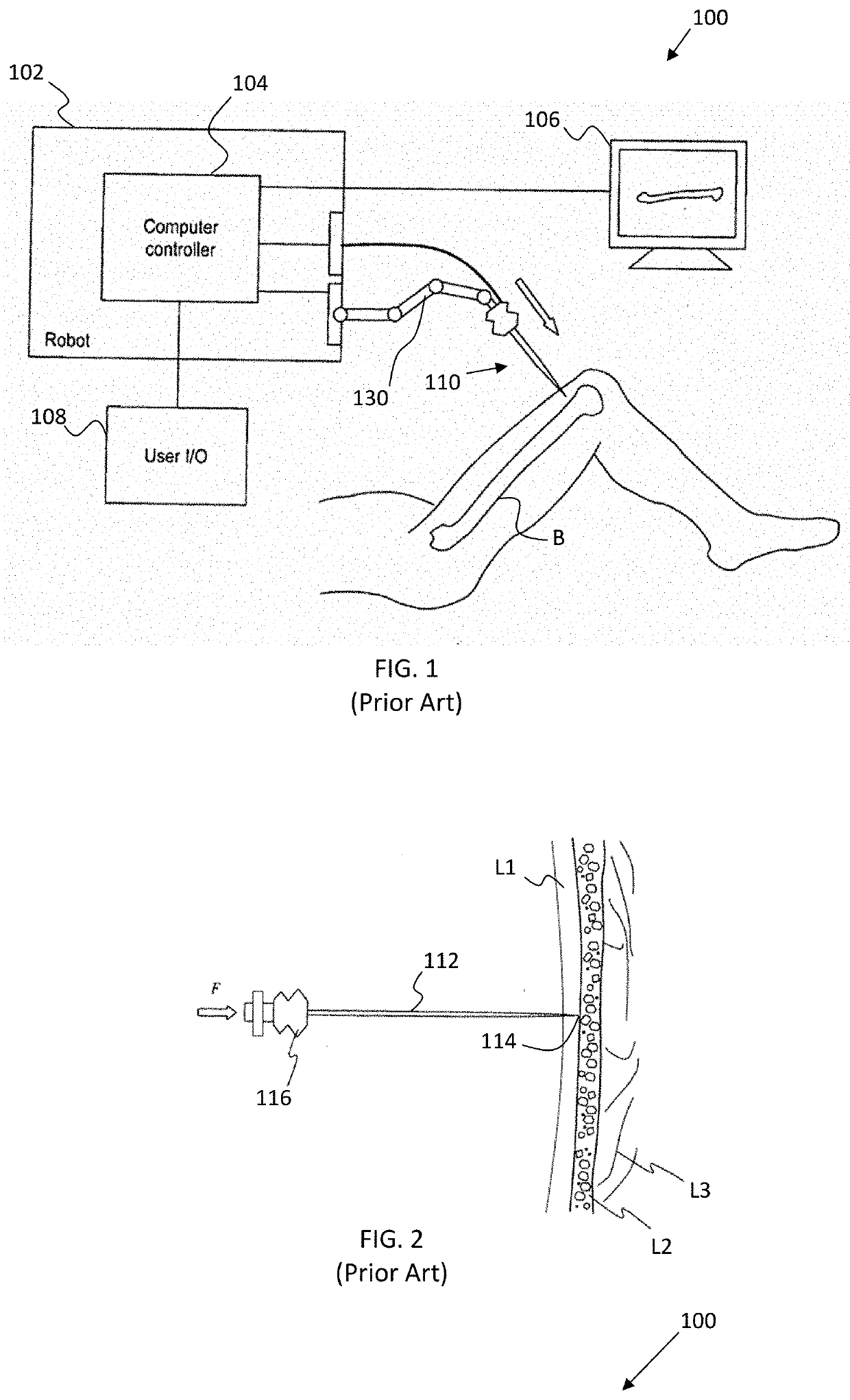 Force based digitization for bone registration