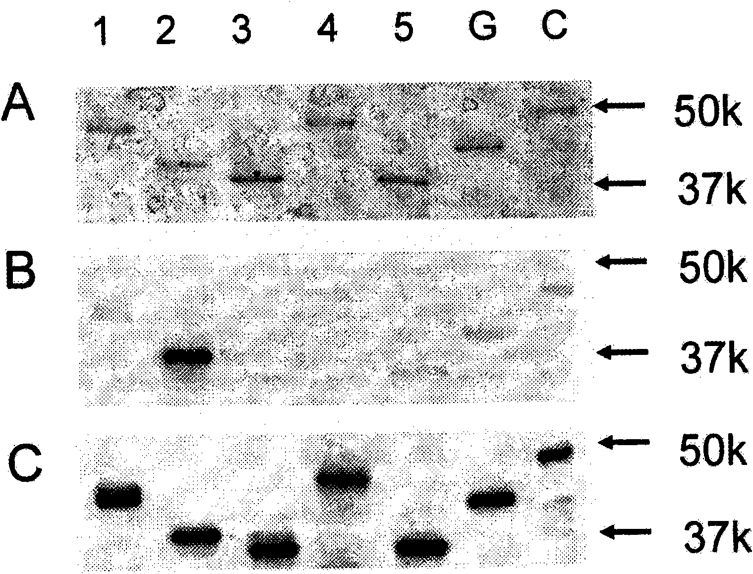 Method for detecting gynecological cancer