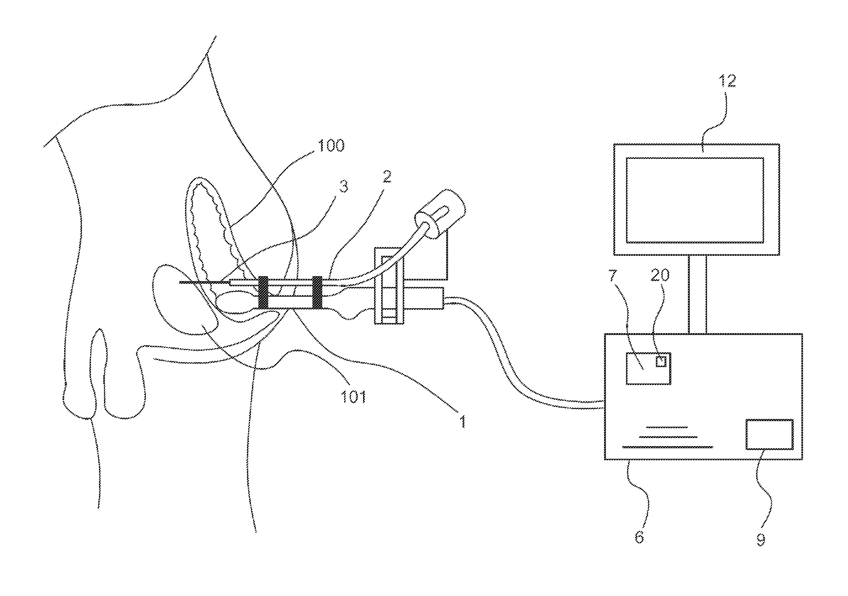Device for guiding a medical imaging probe and method for guiding such a probe