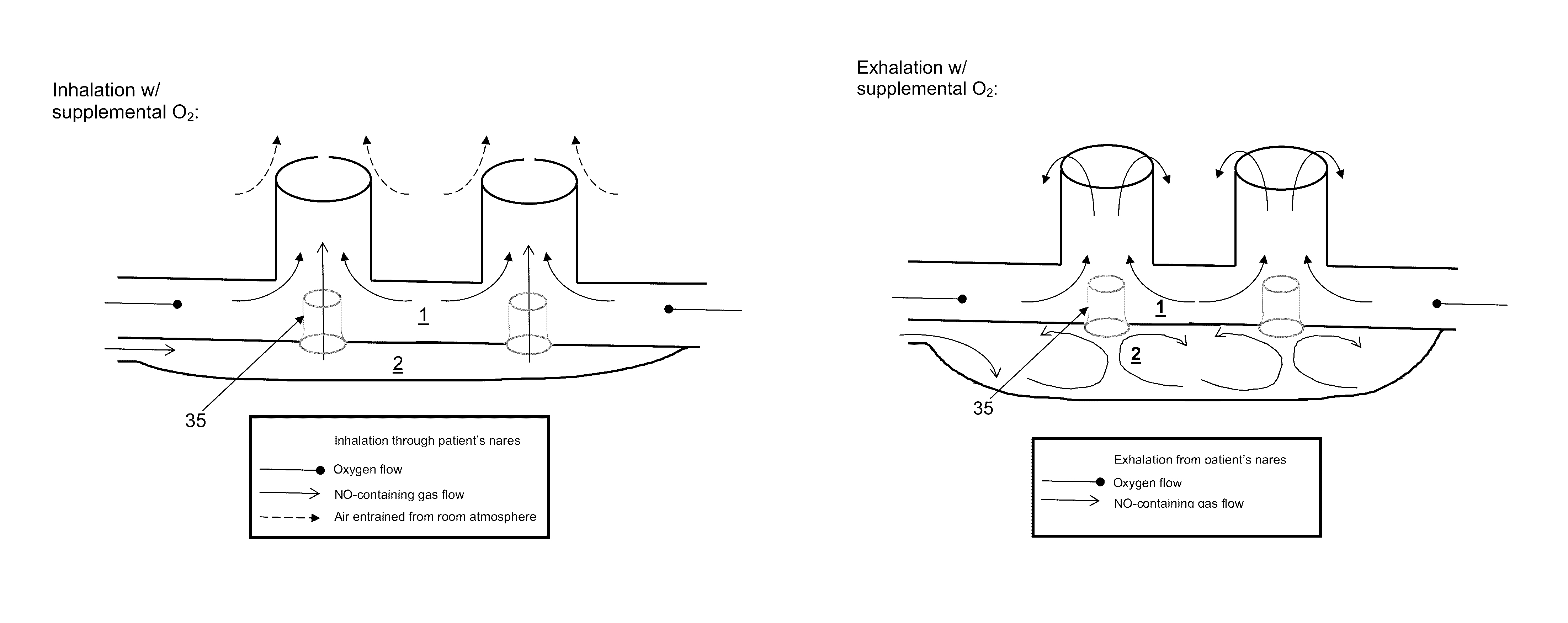 Breathing assistance apparatus for delivery of nitric oxide to a patient by means of a nasal cannula assembly with flow control passage