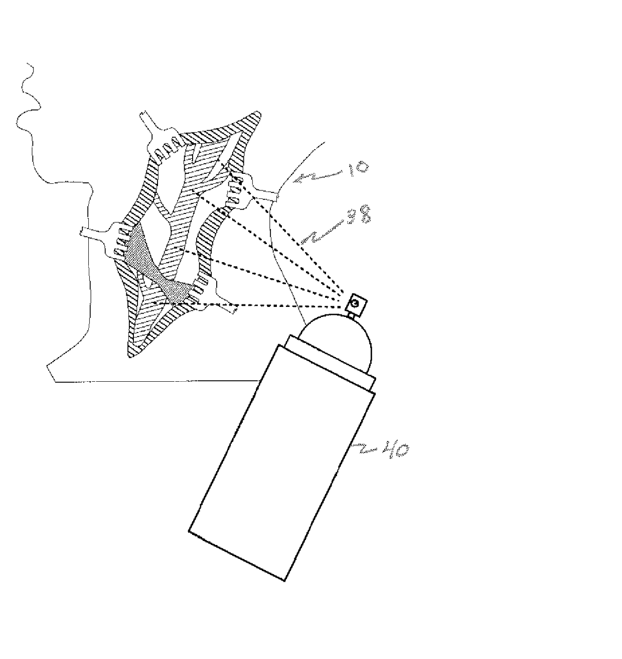 Expandable medical device and method of use