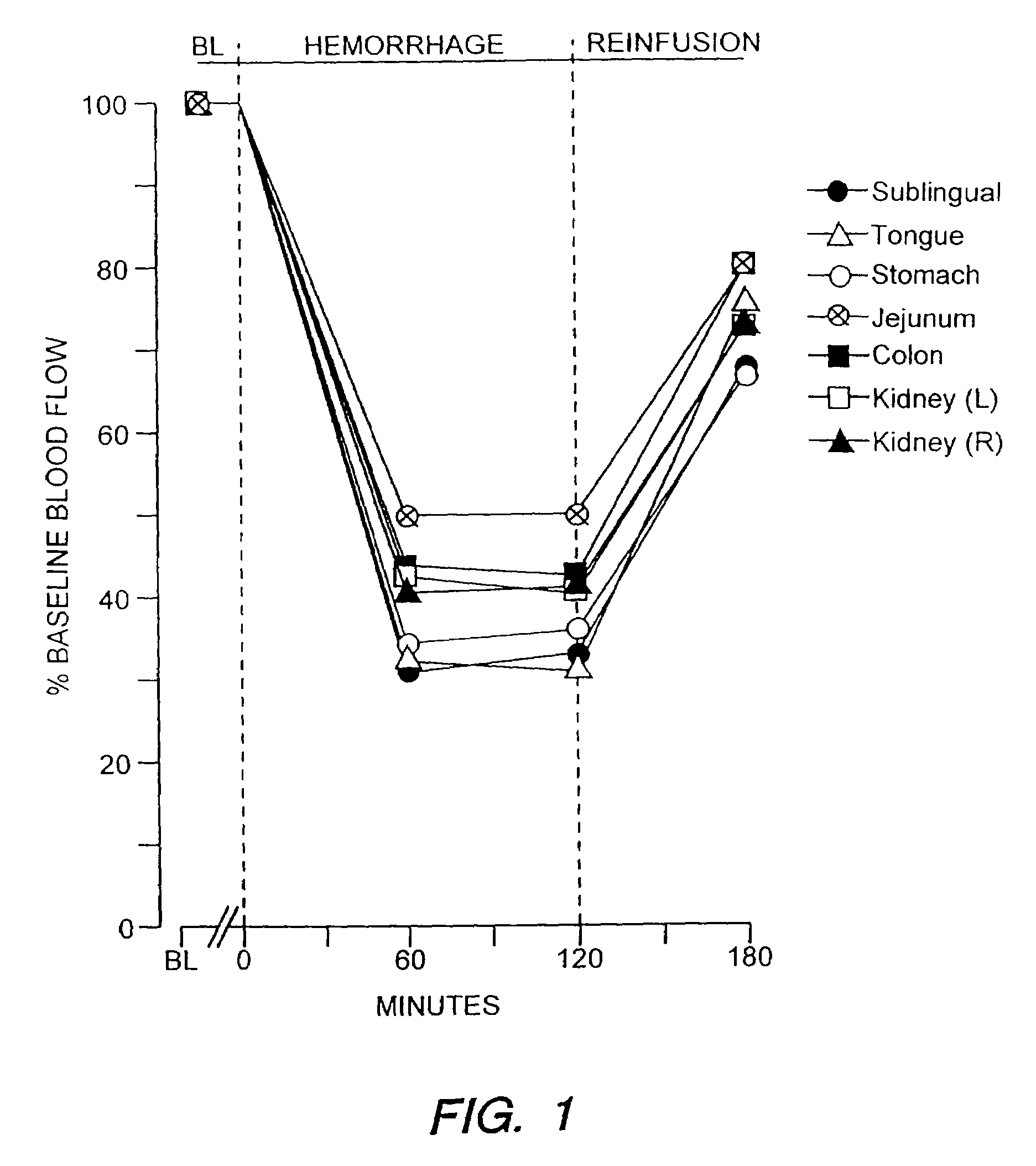 Device for assessing perfusion failure in a patient by measurement of blood flow