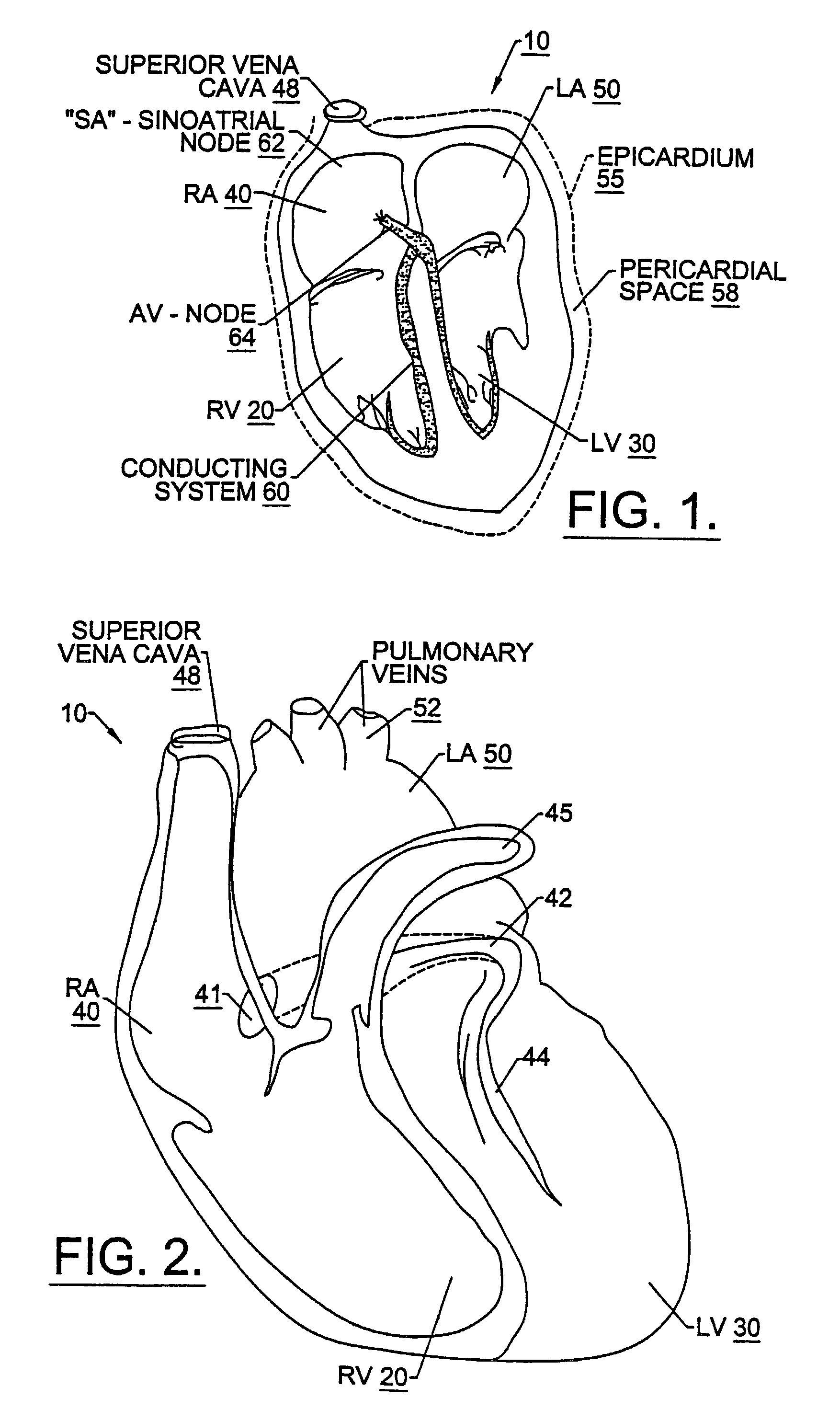 Post-defibrillation pacing methods and devices