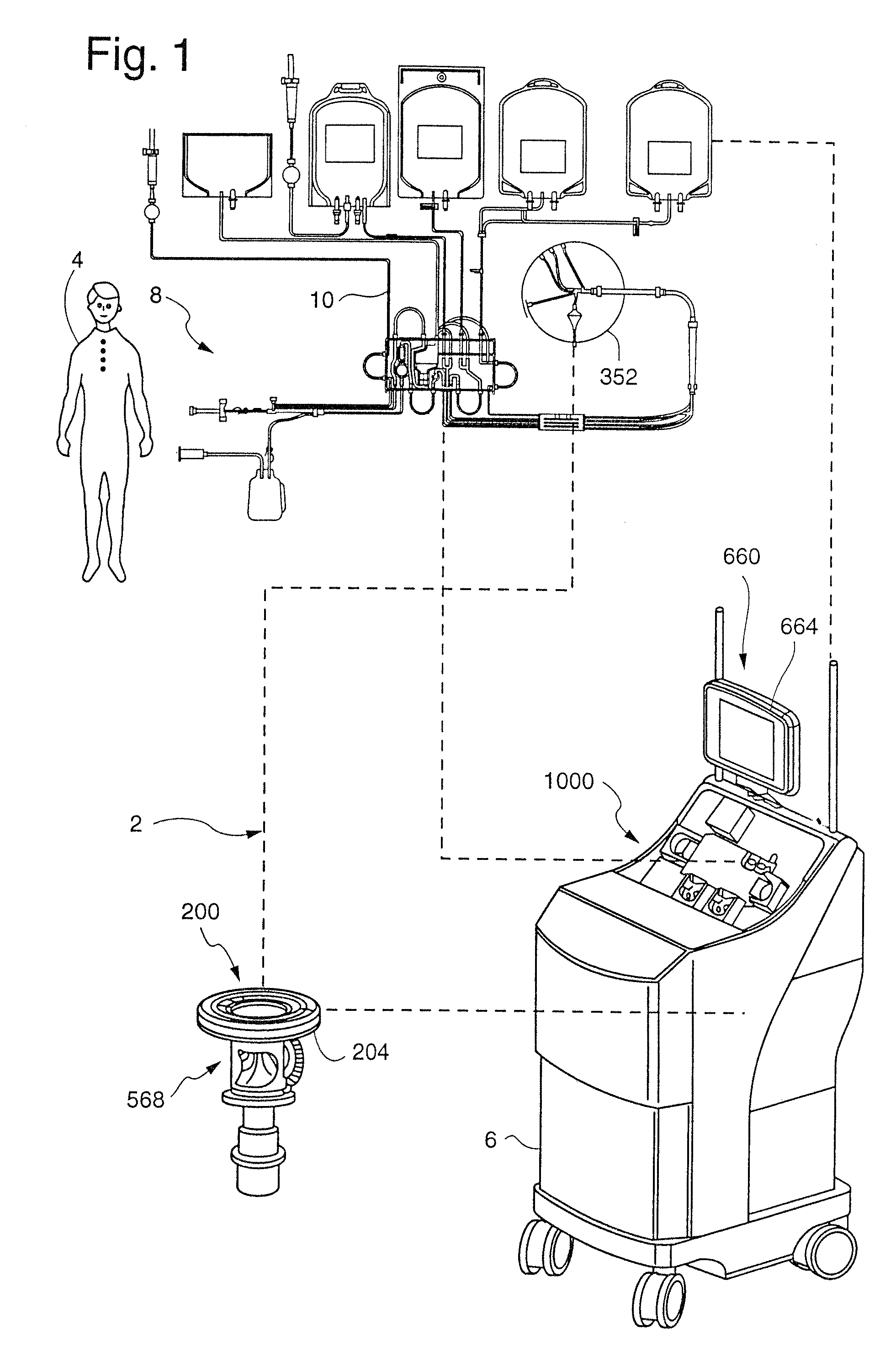 Extra-corporeal blood processing method and apparatus based on donor characteristics