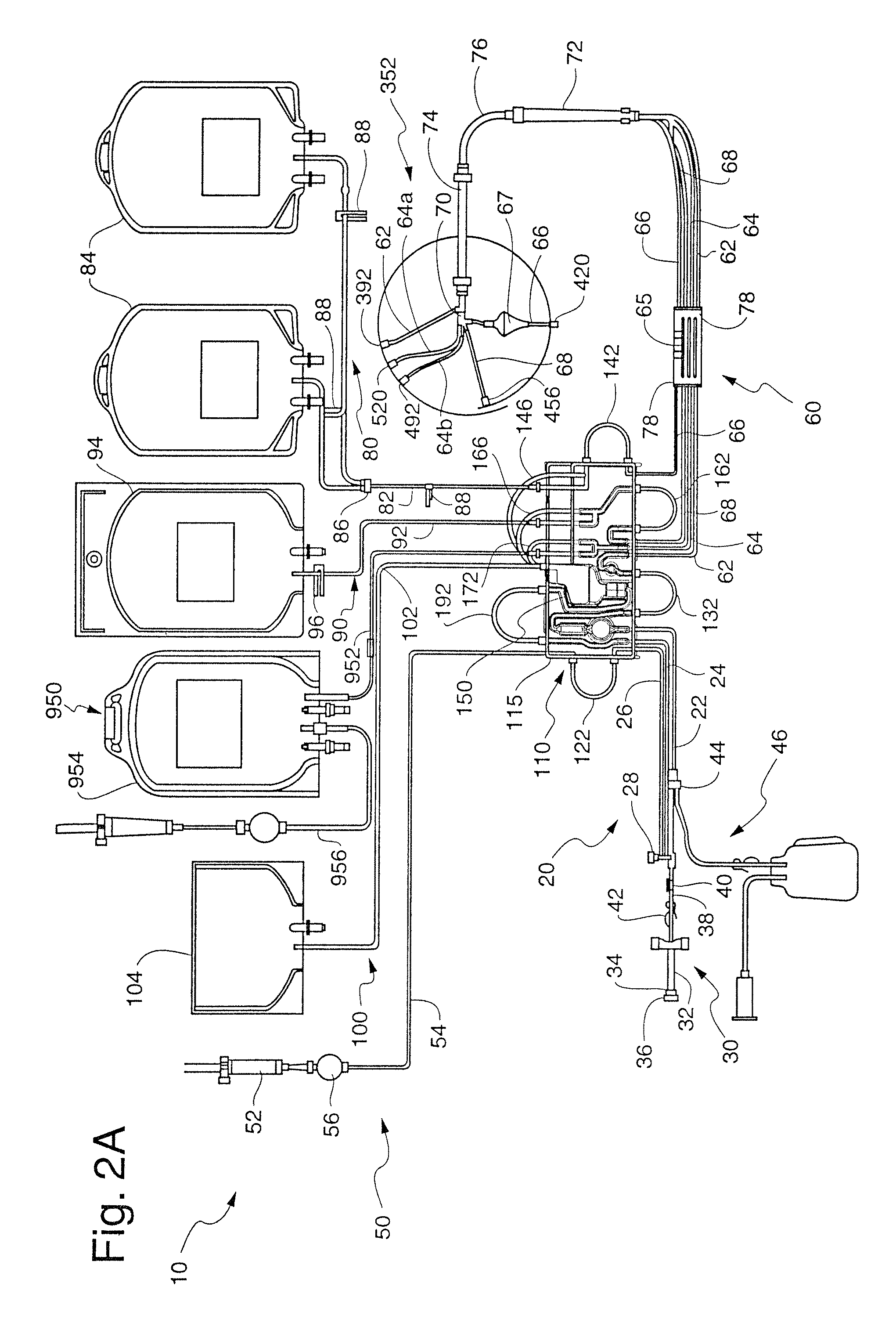 Extra-corporeal blood processing method and apparatus based on donor characteristics