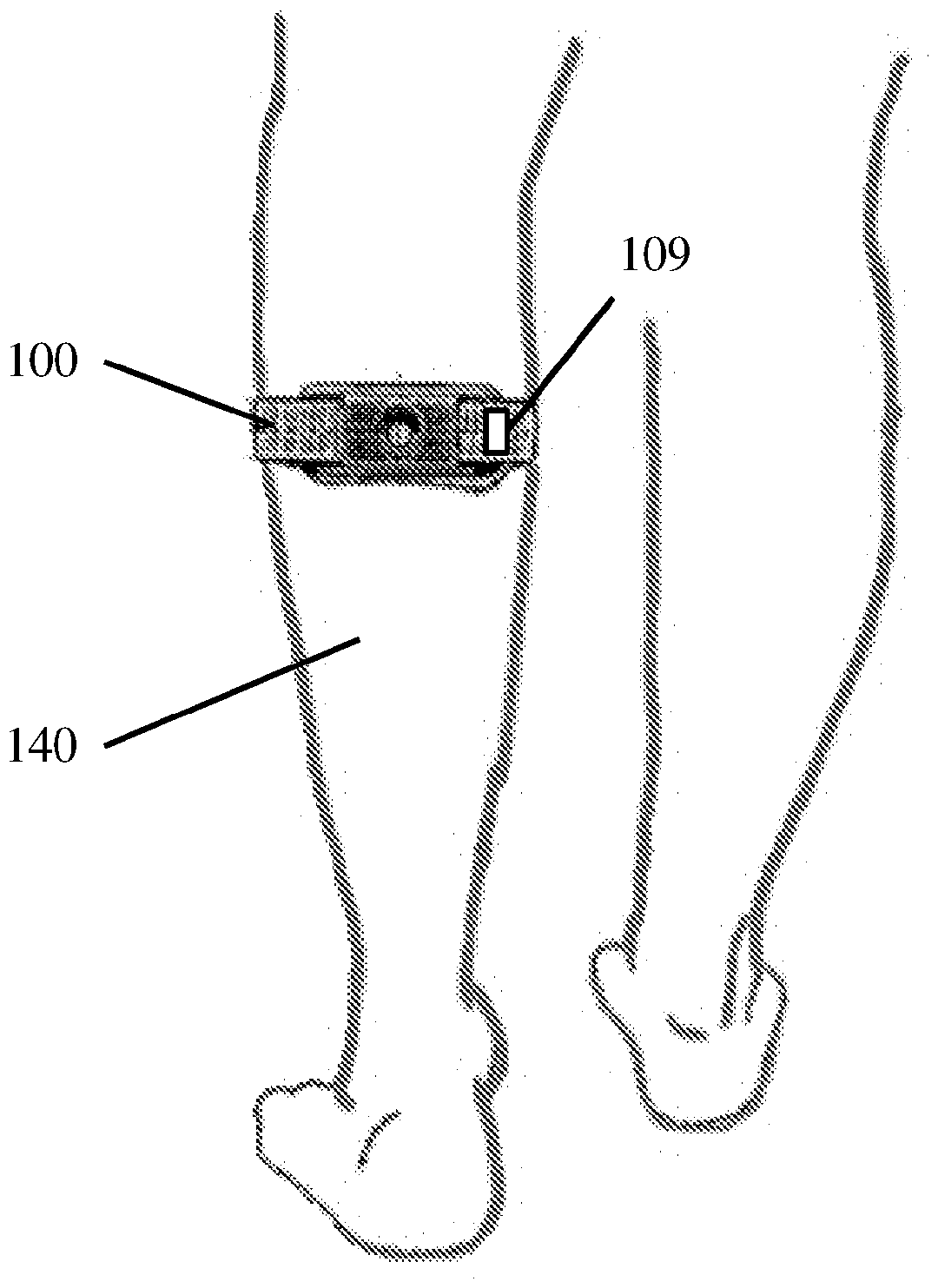 Enhanched transcutaneous electrical nerve stimulator with automatic detection of leg orientation and motion for enhanced sleep analysis