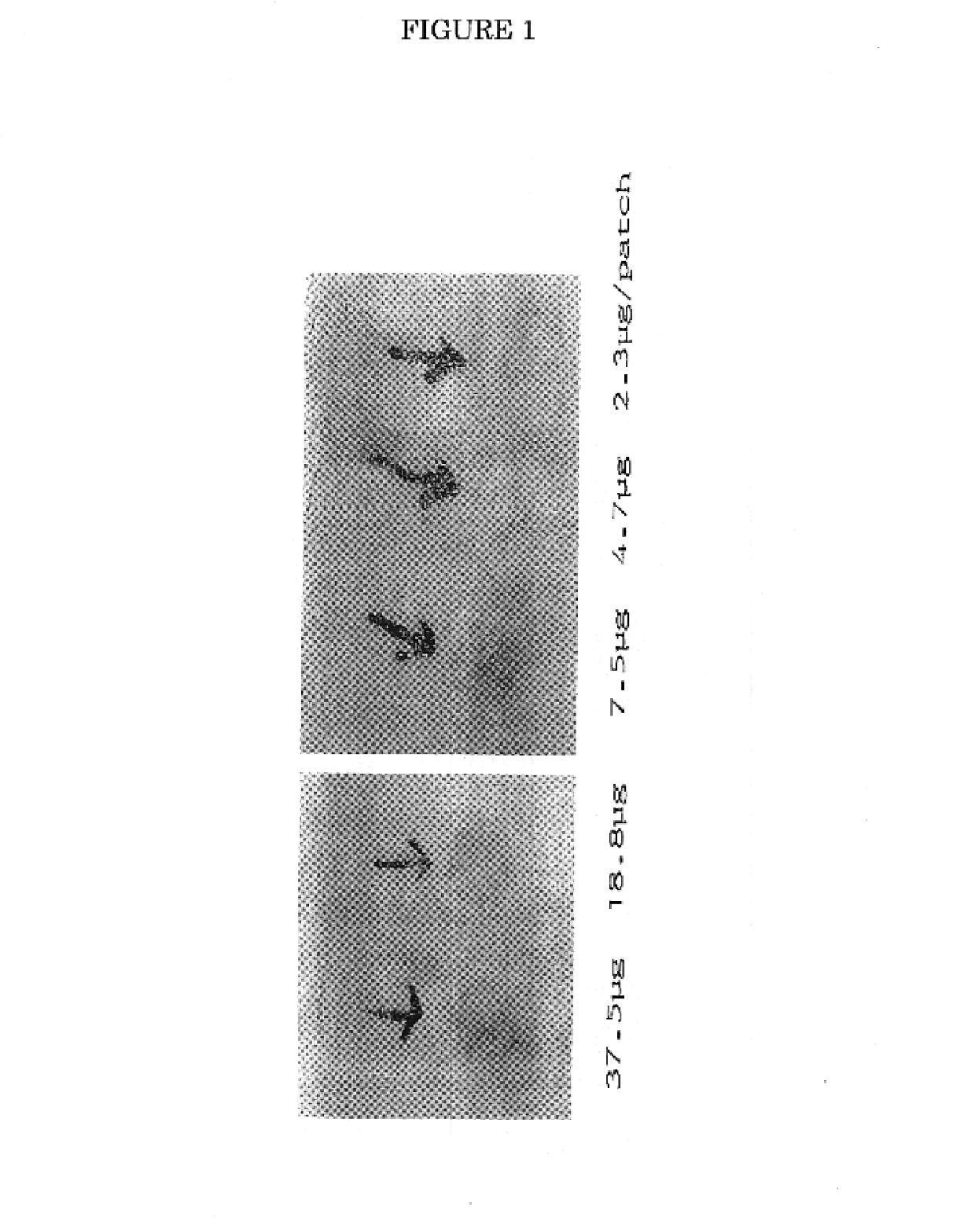 Method and compositions for detection and diagnosis of infectious diseases